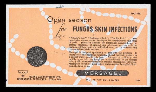 Open season for fungus skin infections.