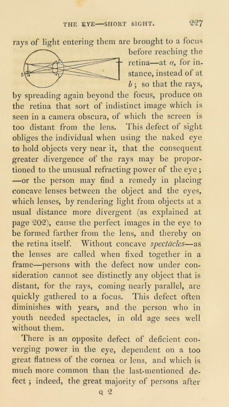 C>On 'ays of light entering them are brought to a focus before reaching the retina—at a, for in- stance, instead of at b ; so that the rays, by spreading again beyond the focus, produce on the retina that sort of indistinct image which is seen in a camera obscura, of which the screen is too distant from the lens. This defect of sight obliges the individual when using the naked eye to hold objects very near it, that the consequent greater divergence of the rays may be propor- tioned to the unusual refracting power of the eye ; —or the person may find a remedy in placing concave lenses between the object and the eyes, which lenses, by rendering light from objects at a usual distance more divergent (as explained at page 202), cause the perfect images in the eye to be formed farther from the lens, and thereby on the retina itself. Without concave siiectacles—as the lenses are called when fixed together in a frame—persons with the defect now under con- sideration cannot see distinctly any object that is distant, for tlie rays, coming nearly parallel, are quickly gathered to a focus. This defect often diminishes with years, and the person who in youth needed spectacles, in old age sees well without them. There is an opposite defect of deficient con- verging power in the eye, dependent on a too great fiatness of the cornea or lens, and which is much more common than the last-mentioned de- fect \ indeed, the great majority of persons after Q 2