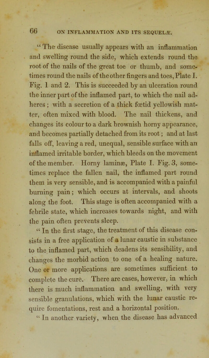 G6 “ The- disease usually appears with an inflammation . and swelling round the side, which extends round the root of the nails of the great toe or thumb, and some- times round the nails of the other fingers and toes, Plate I. Fig. 1 and 2. This is succeeded by an ulceration round the inner part of the inflamed part, to which the nail ad- heres ; with a secretion of a thick foetid yellowish mat- ter, often mixed with blood. The nail thickens, and changes its colour to a dark brownish homy appearance, and becomes partially detached from its root; and at last falls off, leaving a red, unequal, sensible surface with an inflamed irritable border, which bleeds on the movement of the member. Homy laminee, Plate I. Fig. 3, some- times replace the fallen nail, the inflamed part round them is very sensible, and is accompanied with a painful burning pain; which occurs at intervals, and shoots along the foot. This stage is often accompanied with a febrile state, which increases towards night, and with the pain often prevents sleep. “ In the first stage, the treatment of this disease con- sists in a free application of a lunar caustic in substance to the inflamed part, which deadens its sensibility, and changes the morbid action to one of a healing nature. One or more applications are sometimes sufficient to complete the cure. There are cases, however, in which there is much inflammation and swelling, with very sensible granulations, which with the lunar caustic re- quire fomentations, rest and a horizontal position. “ In another variety, when the disease has advanced