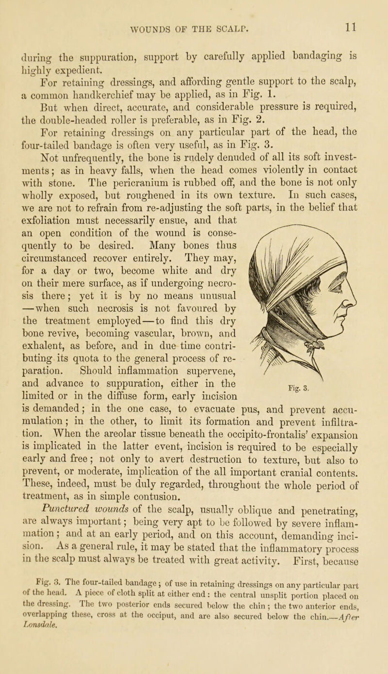 during the suppuration, support by carefully applied bandaging is liighly expedient. For retaining dressings, and affording gentle support to the scalp, a common handkerchief may be applied, as in Fig. 1. But when direct, accurate, and considerable pressure is required, the double-headed roller is preferable, as in Fig. 2. For retaining dressings on any particular part of the head, the four-tailed bandage is often very useful, as in Fig. 3. Not unfrequently, the bone is rudely denuded of all its soft invest- ments ; as in heavy falls, when the head comes violently in contact with stone. The pericranium is rubbed off, and the bone is not only wholly exposed, but roughened in its own texture. In such cases, we are not to refrain from re-adjusting the soft parts, in the belief that exfoliation must necessarily ensue, and that an open condition of the wound is conse- quently to be desired. Many bones thus circumstanced recover entirely. They may, for a day or two, become white and dry on their mere surface, as if undergoing necro- sis there; yet it is by no means unusual —when such necrosis is not favoured by the treatment employed—to find this dry bone revive, becoming vascular, brown, and exhalent, as before, and in due time contri- buting its quota to the general process of re- paration. Should inflammation supervene, and advance to suppuration, either in the limited or in the diflfuse form, early incision is demanded; in the one case, to evacuate pus, and prevent accu- mulation ; in the other, to limit its formation and prevent infiltra- tion. When the areolar tissue beneath the occipito-frontalis’ expansion is implicated in the latter event, incision is required to be especially early and free; not only to avert destruction to texture, but also to prevent, or moderate, implication of the all important cranial contents. These, indeed, must be duly regarded, throughout the whole period of treatment, as in simple contusion. Punctured wounds of the scalp, usually oblique and penetrating, are always important; being very apt to be followed by severe inflam- mation ; and at an early period, and on this account, demanding inci- sion. As a general rule, it may be stated that the inflammatory process in the scalp must always be treated with great activity. First, because Fig. 3. Fig. 3. The four-tailed bandage; of use in retaining dressings on any particular part of the head. A piece of cloth split at either end : the central unsplit portion placed on tlie dressing. The two posterior ends secured below the chin; the two anterior ends, overlapping these, cross at the occiput, and are also secured below the chin.—After Lonsdale.