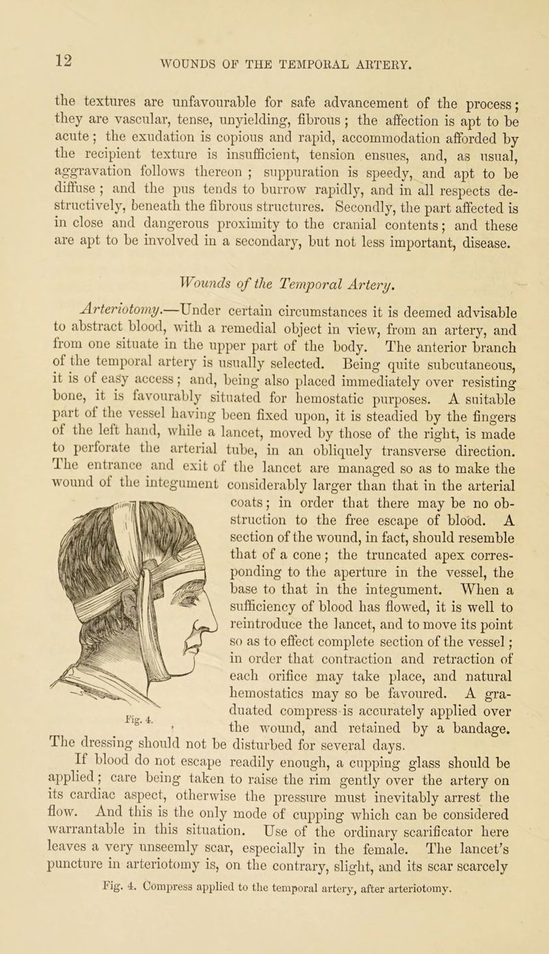 the textures are unfavourable for safe advancement of the process; they are vascular, tense, unyielding, fibrous ; the affection is apt to be acute; the exudation is copious and rapid, accommodation afforded by the recipient texture is insufficient, tension ensues, and, as usual, aggravation follows thereon ; suppuration is speedy, and apt to be diffuse ; and the pus tends to burrow rapidly, and in all respects de- structively, beneath the fibrous structures. Secondly, the part affected is in close and dangerous proximity to the cranial contents; and these are apt to be involved in a secondary, but not less important, disease. Wounds of the Temporal Artery, Artenotomy.—Under certain circumstances it is deemed advisable to abstract blood, with a remedial object in view, from an artery, and from one situate in the upper part of the body. The anterior branch of the temporal artery is usually selected. Being quite subcutaneous, it is of easy access; and, being also placed immediately over resisting bone, it is favourably situated for hemostatic purposes. A snitable part of the vessel having been fixed upon, it is steadied by the fingers of the left hand, while a lancet, moved by those of the right, is made to perforate the arterial tube, in an obliquely transverse direction. The entrance and exit of the lancet are managed so as to make the considerably larger than that in the arterial coats; in order that there may be no ob- struction to the free escape of blood. A section of the wound, in fact, should resemble that of a cone ; the truncated apex corres- ponding to the aperture in the vessel, the base to that in the integument. When a sufficiency of blood has flowed, it is well to reintroduce the lancet, and to move its point so as to effect complete section of the vessel; in order that contraction and retraction of each orifice may take place, and natural hemostatics may so be favoured. A gra- duated compress is accurately applied over the wound, and retained by a bandage. The dressing should not be disturbed for several days. If blood do not escape readily enough, a cupping glass should be applied ,* care being taken to raise the rim gently over the artery on its cardiac aspect, otherwise the pressure must inevitably arrest the flow. And this is the only mode of cupping which can be considered warrantable in this situation. Use of the ordinary scarificator here leaves a very unseemly scar, especially in the female. The lancet's puncture in arteriotomy is, on the contrary, slight, and its scar scarcely tig. 4. Compress applied to the temporal artery, after arteriotomy.