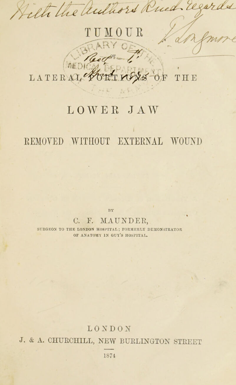 TUMOUR ^•<rUjk,.RY L‘ •“» i ^ ^ ' f C*7 ;. LATERA ^ . I -0,P THE LOAVER JAW REMOVED AVmiOUT EXTERNAL WOUND BY C. F. MAUA^DER, SURGKON TO THK LONDON HOSPITAL; rORMEKLY DEMONSTRATOR OF ANATOMY IN GUY’S HOSTITAL. L 0 X D 0 X J. & A. CHURCHILL, NEW BURLINGTON STREET 1874