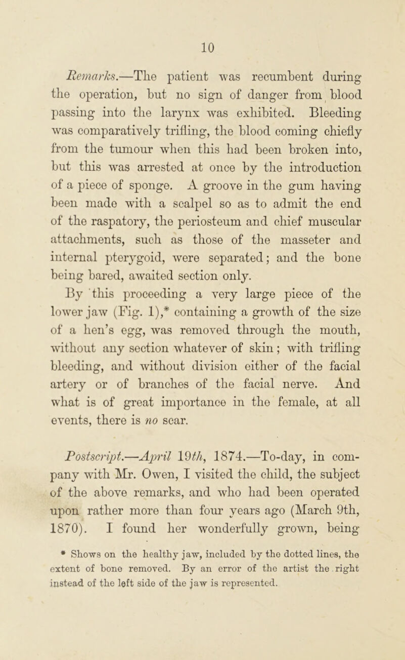 Remarks.—Tlie patient was recumbent during tlie operation, but no sign of danger from blood j:»assing into the larynx was exhibited. Bleeding was comparatively trifling, the blood coming chiefly from the tumour wdien this had been broken into, but this was arrested at once by the introduction of a piece of sponge. A groove in the gum having been made with a scalpel so as to admit the end of the raspatory, the periosteum and chief muscular attachments, such as those of the masseter and internal pterygoid, were separated; and the bone being bared, awmited section only. By 'this proceeding a very large piece of the lower jaw (Fig. 1),* containing a growth of the size of a hen’s egg, was removed through the mouth, without any section whatever of skin; with trifling bleeding, and without division either of the facial artery or of branches of the facial nerve. And what is of great importance in the female, at all events, there is no scar. Postscript.—April 1874.—To-day, in com- pany with Mr. Owen, I visited the child, the subject of the above remarks, and who had been operated upon rather more than four years ago (March 9th, 1870). I found her wonderfully grown, being * Shows on the healthy jaw, included by the dotted lines, the extent of bone removed. By an error of the artist the right instead of the left side of the Jaw is represented.