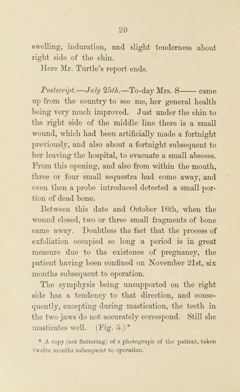 swelling, induration, and slight tenderness about right side of the ehin. Here j\Ir. Tiudle’s report ends. Postscript.—Jiilu 26t/i.—To-day Mrs, S came up from the country to see me, her general health being very much improved. Just under the chin to the right side of the middle line there is a small wound, which had been artificially made a fortnight previously, and also about a fortnight subsequent to lier leaving the hospital, to evacuate a small abscess. From this opening, and also from within the mouth, three or four small sequestra had come away, and even then a probe introduced detected a small por- tion of dead bone. Between this date and October 16th, when the wound closed, two or three small fragments of bone came away. Doubtless the fact that the process of exfoliation occupied so long a period is in great measure due to the existence of pregnancy, the patient having been confined on November 21st, six months subsequent to operation. The symphysis being unsupported on the right side has a tendency to that direction, and conse- quently, excepting during mastication, the teeth in the two jaws do not accurately corresjiond. Still she masticates well. (Fig. 5.)* * A copy (not flattering) of a photograph of the patient, taken ‘twelve months subsequent to operation.