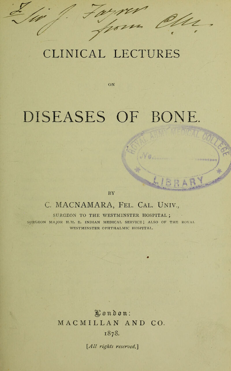 ON DISEASES OF BONE. C. MACNAMARA, Fel. Cal. Univ., SURGEON TO THE WESTMINSTER HOSPITAL ; SURGEON MAJOR H.M. E. INDIAN MEDICAL SERVICE; ALSO OF THE ROYAI. WESTMINSTER OPHTHALMIC HOSPITAL. 0 n h o n: MACMILLAN AND CO. 1878. \All rights reserved.]