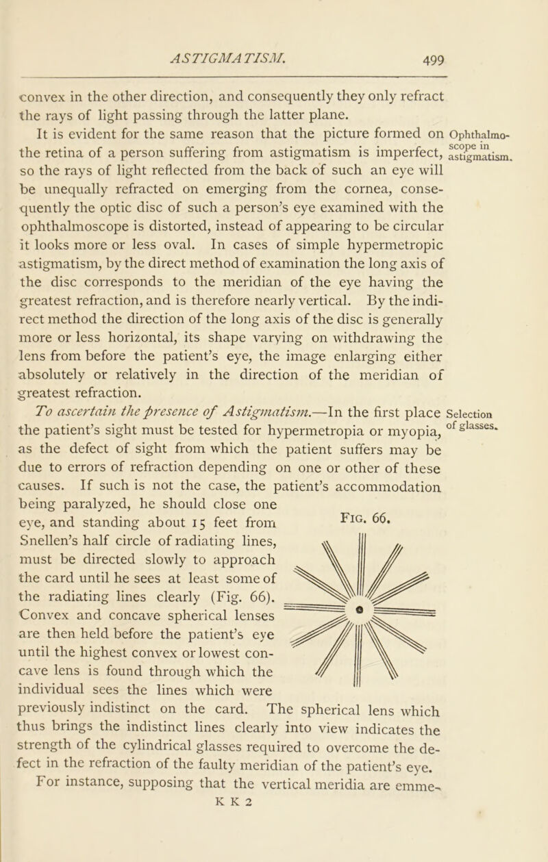 convex in the other direction, and consequently they only refract the rays of light passing through the latter plane. It is evident for the same reason that the picture formed on Ophthalmo- the retina of a person suffering from astigmatism is imperfect, astigmatism, so the rays of light reflected from the back of such an eye will be unequally refracted on emerging from the cornea, conse- quently the optic disc of such a person’s eye examined with the ophthalmoscope is distorted, instead of appearing to be circular it looks more or less oval. In cases of simple hypermetropic astigmatism, by the direct method of examination the long axis of the disc corresponds to the meridian of the eye having the greatest refraction, and is therefore nearly vertical. By the indi- rect method the direction of the long axis of the disc is generally more or less horizontal, its shape varying on withdrawing the lens from before the patient’s eye, the image enlarging either absolutely or relatively in the direction of the meridian of greatest refraction. To ascertain the presence of Astigmatism.—In the first place Selection the patient’s sight must be tested for hypermetropia or myopia, of glasses* as the defect of sight from which the patient suffers may be due to errors of refraction depending on one or other of these causes. If such is not the case, the patient’s accommodation being paralyzed, he should close one eye, and standing about 15 feet from Snellen’s half circle of radiating lines, must be directed slowly to approach the card until he sees at least some of the radiating lines clearly (Fig. 66). Convex and concave spherical lenses are then held before the patient’s eye until the highest convex or lowest con- cave lens is found through which the individual sees the lines which were previously indistinct on the card. The spherical lens which thus brings the indistinct lines clearly into view indicates the strength of the cylindrical glasses required to overcome the de- fect in the refraction of the faulty meridian of the patient’s eye. For instance, supposing that the vertical meridia are emme^ K K 2