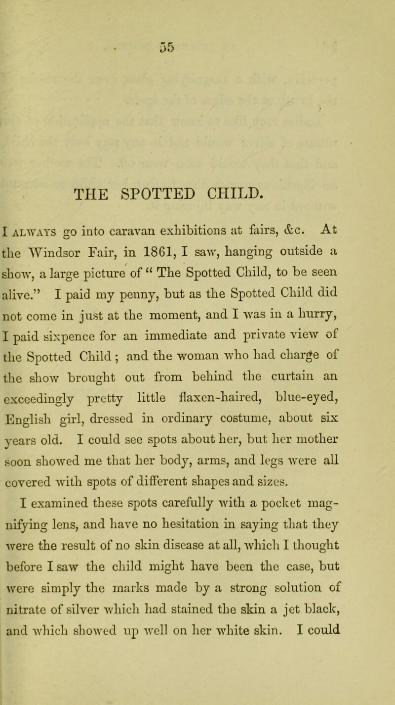 THE SPOTTED CHILD. I ALWAYS go into caravan exhibitions at fairs, &c. At the Windsor Fair, in 1861, I saw, hanging outside a shoAV, a large picture of “ The Spotted Child, to be seen alive.” I paid my penny, but as the Spotted Child did not come in just at the moment, and I was in a hurry, I paid sixpence for an immediate and private view of the Spotted Child ; and the woman who had charge of the show brought out from behind the curtain an exceedingly pretty little flaxen-haired, blue-eyed, English girl, dressed in ordinary costume, about six years old. I could see spots about her, but her mother soon showed me that her body, arms, and legs were all covered with spots of difierent shapes and sizes. I examined these spots carefully with a pocket mag- nifying lens, and have no hesitation in saying that they Avere the result of no skin disease at all, Avhich I thought before I saw the child might have been the case, but were simply the marks made by a strong solution of nitrate of silver which had stained the skin a jet black, and Avhich shoAved up avcII on her white skin. I could