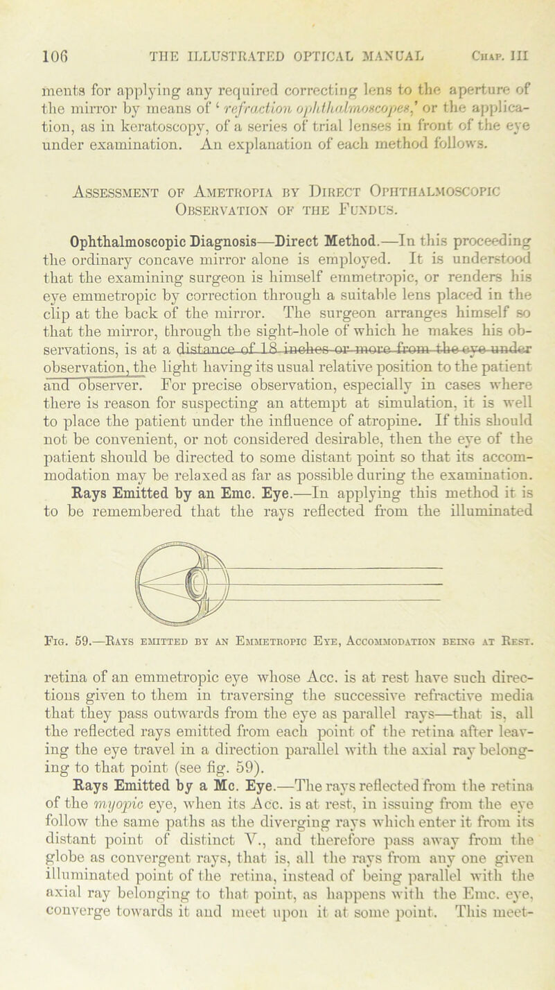 menta for applying any required correcting lens to the aperture of the mirror by means of ‘ refraction ophthalmoscopes' or the applica- tion, as in keratoscopy, of a series of trial lenses in front of the eye under examination. An explanation of each method follows. Assessment of Ametropia by Direct Ophthalmoscopic Observation of the Fundus. Ophthalmoscopic Diagnosis—Direct Method.—In this proceeding the ordinary concave mirror alone is employed. It is understood that the examining surgeon is himself emmetropic, or renders his eye emmetropic by correction through a suitable lens placed in the clip at the back of the mirror. The surgeon arranges himself so that the mirror, through the sight-hole of which he makes his ob- servations, is at a distance-of 18-inches or more from the oye under observation, the light having its usual relative position to the patient aud observer. For precise observation, especially in cases where there is reason for suspecting an attempt at simulation, it is well to place the patient under the influence of atropine. If this should not be convenient, or not considered desirable, then the eye of the patient should be directed to some distant point so that its accom- modation may be relaxed as far as possible during the examination. Rays Emitted by an Emc. Eye.—In applying this method it is to be remembered that the rays reflected from the illuminated Fig. 59.—Rays emitted by an Emmetropic Eye, Accommodation being at Rest. retina of an emmetropic eye whose Acc. is at rest have such direc- tions given to them in traversing the successive refractive media that they pass outwards from the eye as parallel rays—that is, all the reflected rays emitted from each point of the retina after leav- ing the eye travel in a direction parallel with the axial ray belong- ing to that point (see fig. 59). Rays Emitted by a Me. Eye.—The rays reflected from the retina of the myopic eye, when its Acc. is at rest, in issuing from the eye follow the same paths as the diverging rays which enter it from its distant point of distinct V., and therefore pass away from the globe as convergent rays, that is, all the rays from any one given illuminated point of the retina, instead of being parallel with the axial ray belonging to that point, as happens with the Emc. eye, converge towards it and meet upon it at some point. This meet-