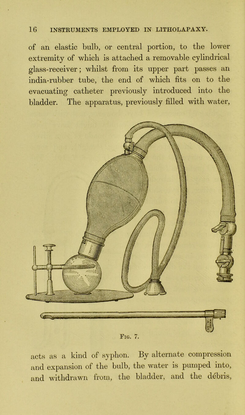 Fig. 7. acts as a kind of syphon. By alternate compression and expansion of the bulb, the water is pumped into, and withdrawn from, the bladder, and the debris, of an elastic bulb, or central portion, to the lower extremity of which is attached a removable cylindrical glass-receiver; whilst from its upper part passes an india-rubber tube, the end of which fits on to the evacuating catheter previously introduced into the bladder. The apparatus, previously filled with water.