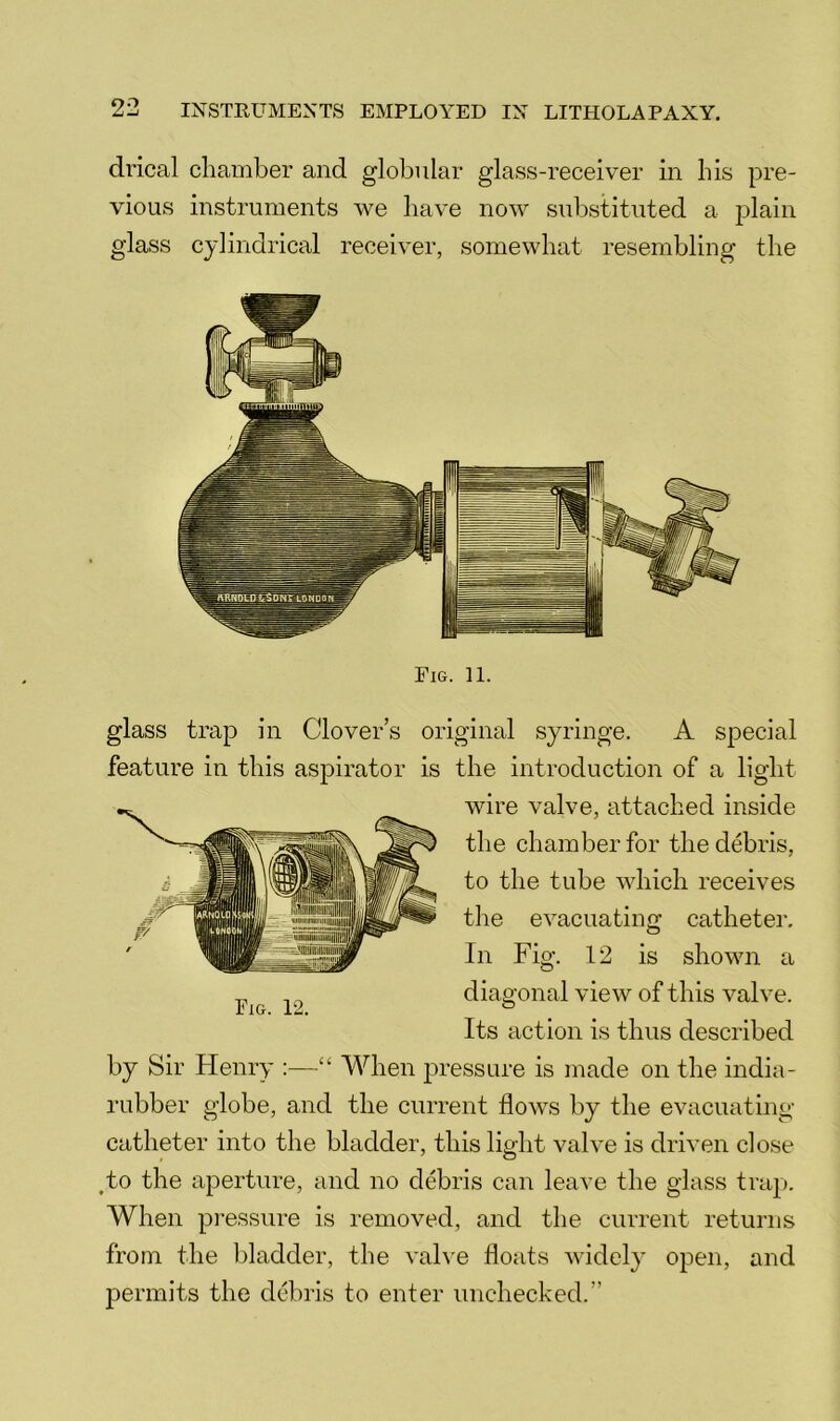 drical cliamber and globular glass-receiver in bis pre- vious instruments we have now substituted a plain glass cylindrical receiver, somewbat resembling tbe Fig. n. glass trap in Clover’s original syringe. A special feature in this aspirator is tbe introduction of a light wire valve, attached inside tbe chamber for tbe debris, to tbe tube which receives tbe evacuating catheter. In Fig. 12 is shown a „ , ^ diagonal view of this valve. Fig. 12. ^ ^ Its action is thus described by Sir Henry :—“ When pressure is made on the india- rubber globe, and tbe current flows by tbe evacuating catheter into tbe bladder, this light valve is driven close Ao the aperture, and no debris can leave tbe glass trap. When pi’essure is removed, and tbe current returns from tbe l)ladder, tbe valve floats widely open, and permits tbe debris to enter unchecked.”
