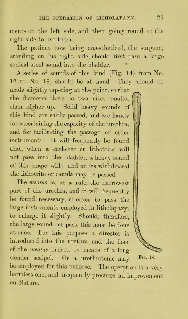 ments on the left side, and then going round to the rio'ht side to nse them. O The patient now being anesthetized, the surgeon, standing on his right side, slionld first pass a large conical steel sound into the bladder. A series of sounds of this kind (Fig. 14), from No. 12 to No. 18, should be at hand. They should be made slightly tapering at the point, so that the diameter there is two sizes smaller than higher up. Solid heavy sounds of this kind are easily passed, and are handy for ascertaining the capacity of the urethra, and for facilitating the passage of other instruments. It will frequently be found that, when a catheter or lithotrite will not pass into the bladder, a heavy sound of this shape will; and on its withdrawal the lithotrite or canula may be passed. The meatus is, as a rule, the narrowest part of the urethra, and it will frequently be found necessary, in order to pass the large instruments employed in litholapaxy, to enlarge it slightly. Should, therefore, the large sound not pass, this must be done at once. For this purpose a director is introduced into the urethra, and the floor of the meatus incised by means of a lono- slender scalpel. Or a urethrotome may be employed for this purpose. The operation is a very harmless one, and frequently procures an improvement on Nature.