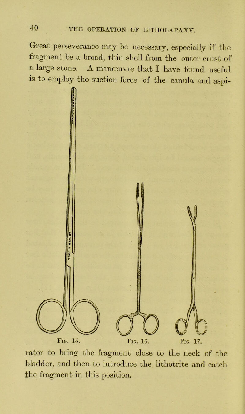 Great perseverance may be necessary, especially if the fragment be a broad, thin shell from the outer crust of a larg'e stone. A manoeuvre that I have found useful is to employ the suction force of the canula and aspi- Fig. 17. rator to bring the fragment close to the neck of the bladder, and then to introduce the lithotrite and catch the fragment in this jeosition.