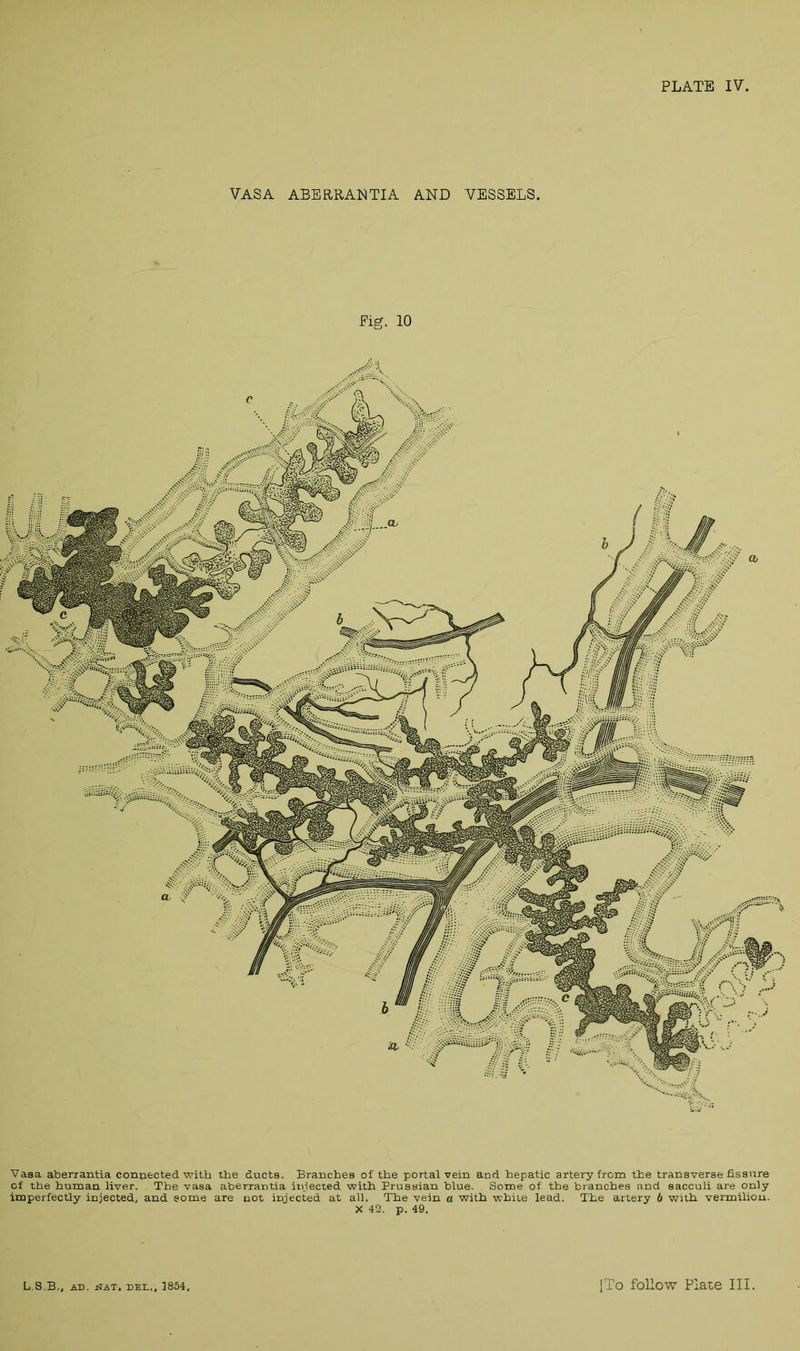 VASA ABERRANTIA AND VESSELS. Pig. 10 Vasa aberrantia connected with the ducts. Branches of the portal vein and hepatic artery from the transverse fissure of the human liver. The vasa aberrantia injected with Prussian blue. Some of the branches and sacculi are only imperfectly injected, and some are not injected at all. The vein a with white lead. The artery 6 with vermilion. X 42. p. 49.