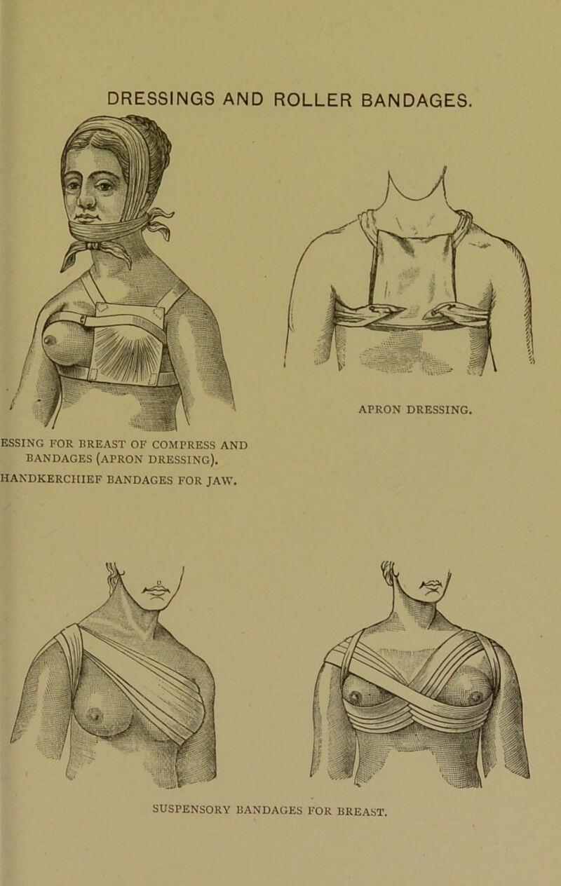 ESSING FOR BREAST OF COMPRESS AND BANDAGES (APRON DRESSING). HANDKERCHIEF BANDAGES FOR JAW. SUSPENSORY BANDAGES FOR BREAST. MW