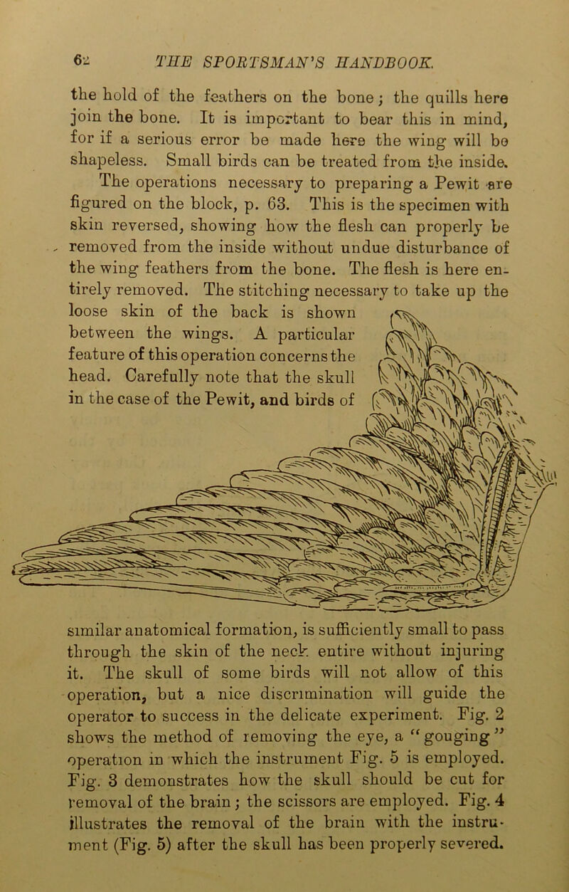 the hold of the feathers on the bone; the quills here join the bone. It is important to bear this in mind, for if a serious error be made here the wing will bo shapeless. Small birds can be treated from the inside. The operations necessary to preparing a Pewit are figured on the block, p. 63. This is the specimen with skin reversed, showing how the flesh can properly be - removed from the inside without undue disturbance of the wing feathers from the bone. The flesh is here en- tirely removed. The stitching necessary to take up the loose skin of the back is shown between the wings. A particular feature of this operation concerns the head. Carefully note that the skull in the case of the Pewit, and birds of similar anatomical formation, is sufficiently small to pass through the skin of the neck entire without injuring it. The skull of some birds will not allow of this operation, but a nice discrimination will guide the operator to success in the delicate experiment. Fig. 2 shows the method of removing the eye, a “ gougiug ” operation in which the instrument Fig. 5 is employed. Fig. 3 demonstrates how the skull should be cut for removal of the brain ; the scissors are employed. Fig. 4 illustrates the removal of the brain with the instru- ment (Fig. 5) after the skull has been properly severed.