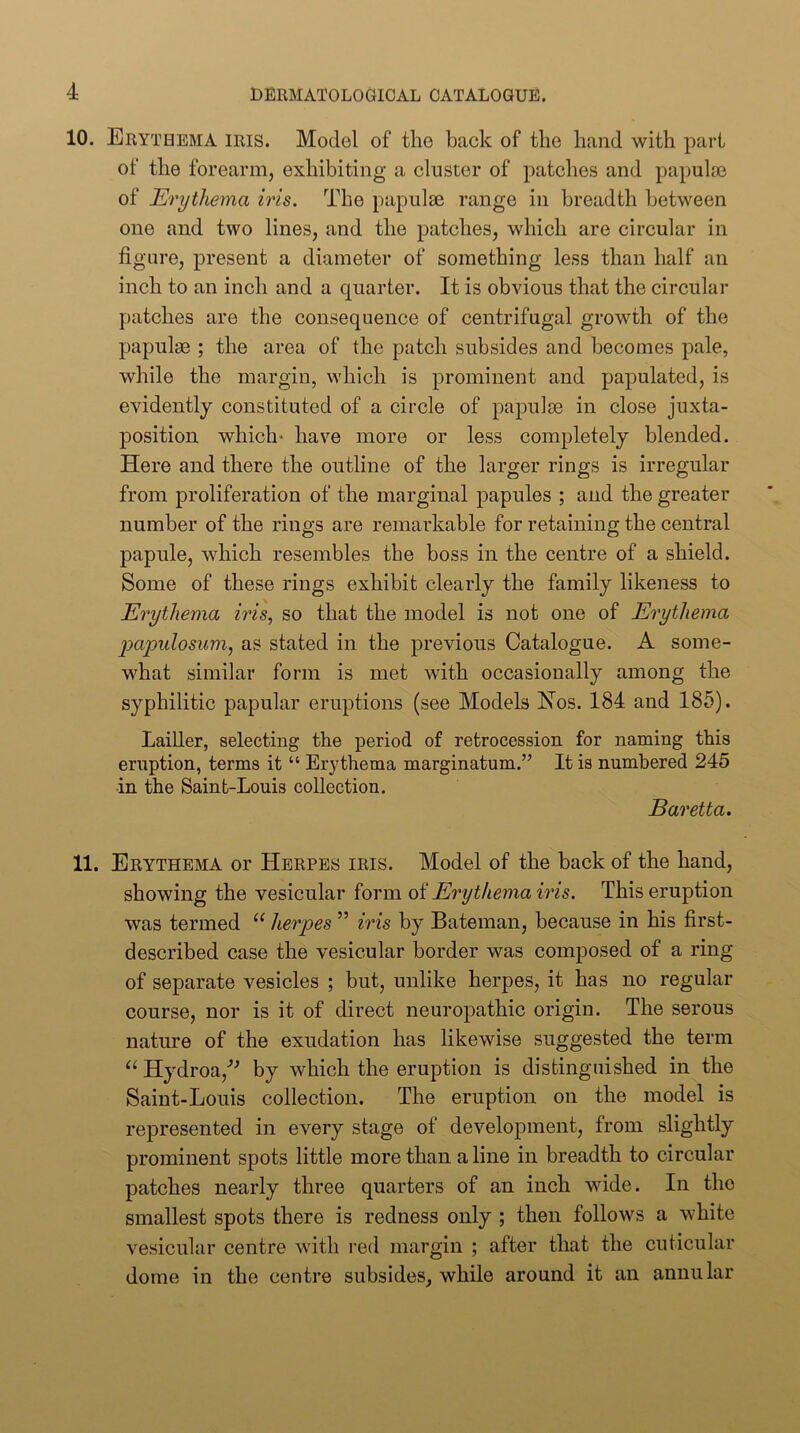 10. Erythema iris. Model of the back of the hand with part of the forearm, exhibiting a cluster of patches and papula3 of Erythema iris. The papulae range in breadth between one and two lines, and the patches, which are circular in figure, present a diameter of something less than half an inch to an inch and a quarter. It is obvious that the circular patches are the consequence of centrifugal growth of the papulae ; the area of the patch subsides and becomes pale, while the margin, which is prominent and papulated, is evidently constituted of a circle of papulae in close juxta- position which- have more or less completely blended. Here and there the outline of the larger rings is irregular from proliferation of the marginal papules ; and the greater number of the rings are remarkable for retaining the central papule, which resembles the boss in the centre of a shield. Some of these rings exhibit clearly the family likeness to Erythema iris, so that the model is not one of Erythema papillosum^ as stated in the previous Catalogue. A some- w^hat similar form is met with occasionally among the syphilitic papular eruptions (see Models Hos. 184 and 185). Lailler, selecting the period of retrocession for naming this eruption, terms it “ Erythema marginatum.” It is numbered 245 in the Saint-Louis collection. Baretta. 11. Erythema or Herpes iris. Model of the back of the hand, showing the vesicular form of Erythema iris. This eruption was termed “ herpes ” iris by Bateman, because in his first- described case the vesicular border was composed of a ring of separate vesicles ; but, unlike herpes, it has no regular course, nor is it of direct neuropathic origin. The serous nature of the exudation has likewise suggested the term “ Hydroa,’^ by which the eruption is distinguished in the Saint-Louis collection. The eruption on the model is represented in every stage of development, from slightly prominent spots little more than a line in breadth to circular patches nearly three quarters of an inch wide. In the smallest spots there is redness only ; then follows a white vesicular centre with I’ed margin ; after that the cuticular dome in the centre subsides, while around it an annular