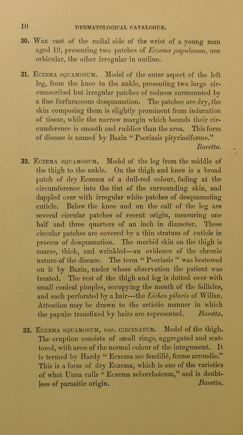 30. Wax cast of the radial side of the wrist of a young man aged 19, presenting two patclies of Eczema papulosum, one orbicular, the other irregular in outline. 31. Eczema squamosum. Model of the outer aspect of the left leg, from the knee to the ankle, presenting two Jarge cir- cumscribed but irregular patches of redness surmounted by a fine furfuraceous desquamation. The patches are dry, the skin composing them is slightly prominent from induration of tissue, while the narrow margin which bounds their cir- cumference is smooth and ruddier than the area. This form * of disease is named by Bazin “ Psoriasis pityriasiforme.’^ Baretta. 32. Eczema squamosum. Model of the leg from the middle of the thigh to the ankle. On the thigh and knee is a broad patch of dry Eczema of a dull-red colour, fading at the circumference into the tint of the surrounding skin, and dappled over with irregular white patches of desquamating cuticle. Below the knee and on the calf of the leg are several circular patches of recent origin, measuring one half and three quarters of an inch in diameter. These circular patches are covered by a thin stratum of cuticle in process of desquamation. The morbid skin on the thigh is coarse, thick, and wrinkled—an evidence of the chronic nature of the disease. The term Psoriasis was bestowed on it by Bazin, under whose observation the patieut was treated. The rest of the thigh and leg is dotted over with small conical pimples, occupying the mouth of the follicles, and each perforated by a hair—the Lichen pilaris of Willan. Attention may be drawn to the artistic manner in which the papulae transfixed by hairs are represented. Baretta. 33. Eczema squamosum, var. circinatum. Model of the thigh. The eruption consists of small rings, aggregated and scat- tered, with areae of the normal colour of the integument. It is termed by Hardy “ Eczema sec fendill^, forme arrondie.” This is a form of dry Eczema, which is one of the varieties of what Unna calls “ Eczema seborrhoicum,’^ and is doubt- less of parasitic origin. Baretta.