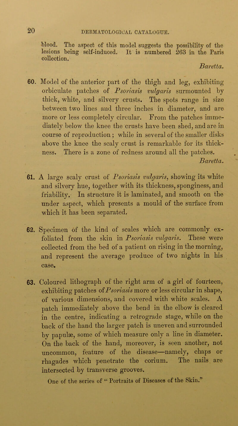 blood. The aspect of this model suggests the possibility of the lesions being self-induced. It is numbered 263 in the Paris collection. Baretta. 60. Model of the anterior part of the thigh and leg, exhibiting orbicnlate patches of Psoriasis vulgaris surmounted by thick, white, and silvery crusts. The spots range in size between two lines and three inches in diameter, and are more or less completely circular. From the patches imme- diately below the knee the crusts have been shed, and are in course of reproduction; while in several of the smaller disks above the knee the scaly crust is remarkable for its thick- ness. There is a zone of redness around all the patches. Baretta. 61. A large scaly crust of Psoriasis vulgaris, showing its white and silvery hue, together with its thickness, sponginess, and friability. In structure it is laminated, and smooth on the under aspect, which presents a mould of the surface from which it has been separated. 62. Specimen of the kind of scales which are commonly ex- foliated from the skin in Psoriasis vulgaris. These were collected from the bed of a patient on rising in the morning, and represent the average produce of two nights in his case. 63. Coloured lithograph of the right arm of a girl of fourteen, exhibiting patches Psoriasis more or less circular in shape, of various dimensions, and covered with white scales. A patch immediately above the bend in the elbow is cleared in the centre, indicating a retrograde stage, while on the back of the hand the larger patch is uneven and surrounded by papulae, some of which measure only a line in diameter. On the back of the hand, moreover, is seen another, not uncommon, feature of the disease—namely, chaps or rhagades which penetrate the corium. The nails are intersected by transverse grooves. One of the series of “ Portraits of Diseases of the Skin.”