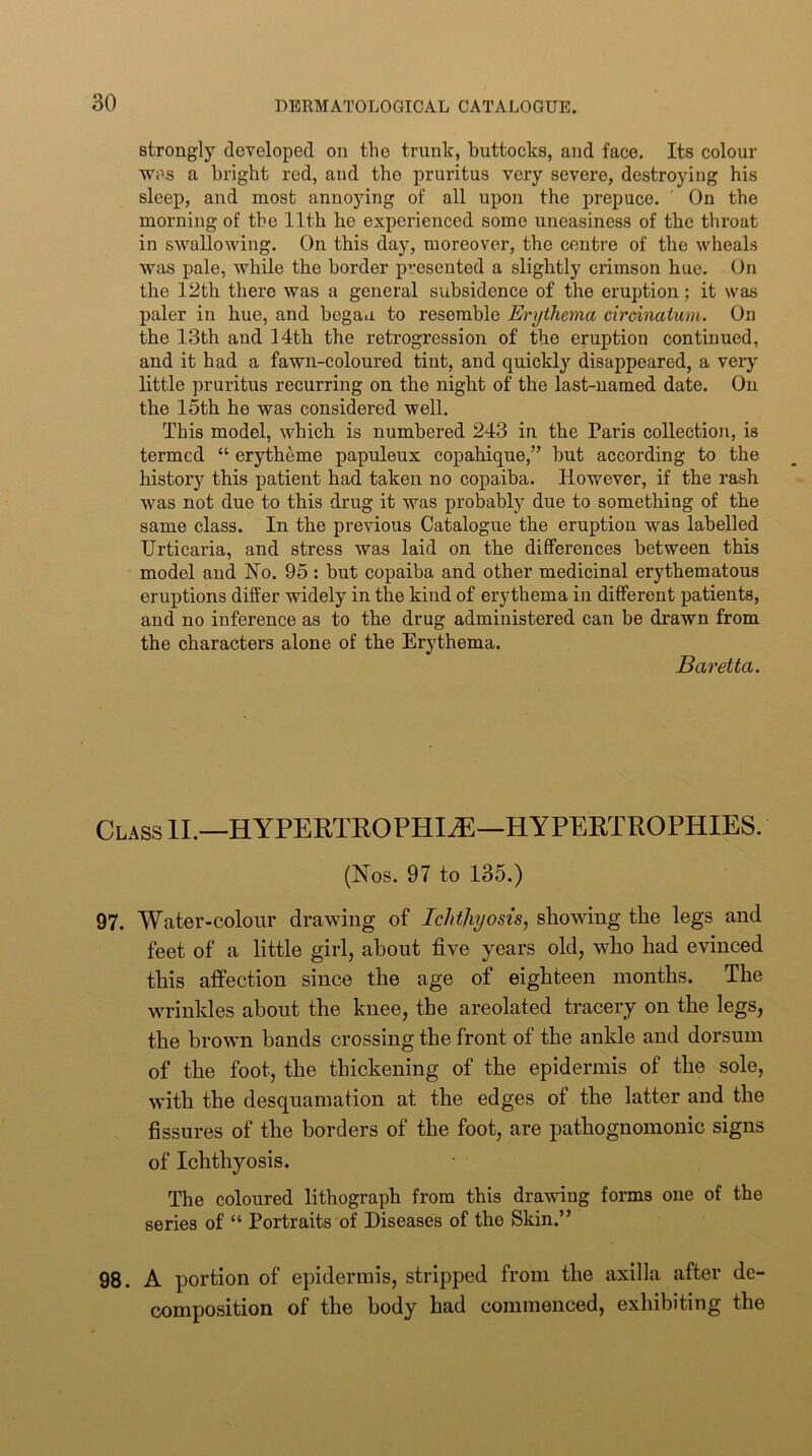 strongly developed on the trunk, buttocks, and face. Its colour was a bright red, and the pruritus very severe, destroying his sleej), and most annoying of all upon the prepuce. ’ On the morning of the 11th he experienced some uneasiness of the throat in swallowing. On this day, moreover, the centre of the wheals was pale, while the border presented a slightly crimson hue. On the 12th there was a general subsidence of the eruption; it was paler in hue, and begau to resemble Erythema circinaium. On the 13th and 14th the retrogression of the eruption continued, and it had a fawn-coloured tint, and quickly disappeared, a very little pruritus recurring on the night of the last-named date. On the 15th he was considered well. This model, which is numbered 243 in the Paris collection, is termed “ erytheme papuleux copahique,” but according to the history this patient had taken no copaiba. However, if the rash was not due to this drug it was probably due to something of the same class. In the previous Catalogue the eruption was labelled Urticaria, and stress was laid on the differences between this model and No. 95 : but copaiba and other medicinal erythematous eruptions differ widely in the kind of erythema in different patients, and no inference as to the drug administered can be drawn from the characters alone of the Erythema. Baretta. Class II.—HYPERTROPHIC—HYPERTROPHIES. (Nos. 97 to 135.) 97. Water-colour drawing of Ichthyosis, showing the legs and feet of a little girl, about five years old, who had evinced this affection since the age of eighteen months. The wrinkles about the knee, the areolated tracery on the legs, the brown hands crossing the front of the ankle and dorsum of the foot, the thickening of the epidermis of the sole, with the desquamation at the edges of the latter and the fissures of the borders of the foot, are pathognomonic signs of Ichthyosis. The coloured lithograph from this drawing forms one of the series of “ Portraits of Diseases of the Skin.” 98. A portion of epidermis, stripped from the axilla after de- composition of the body had commenced, exhibiting the