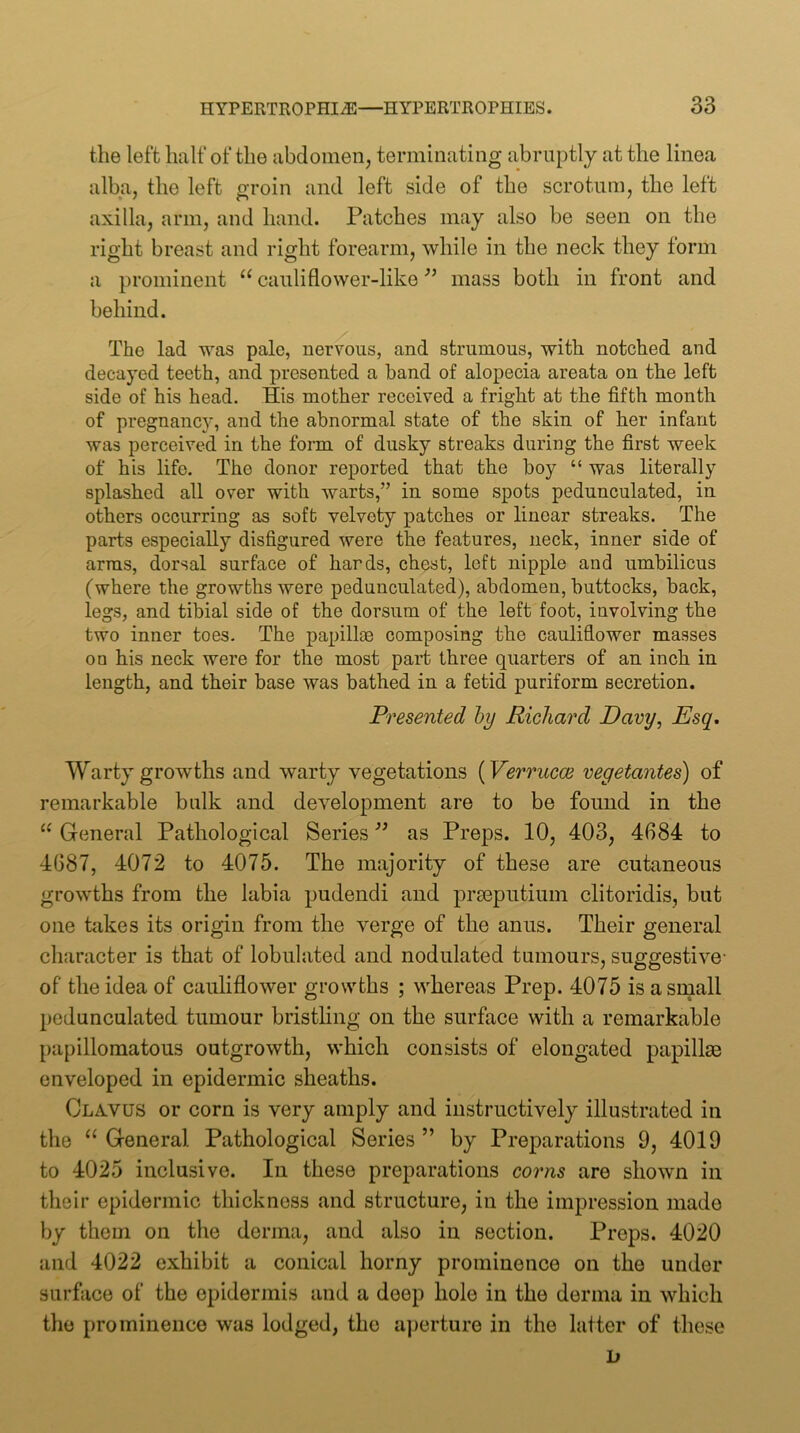 the left half of the abdomen, terminating abruptly at the linea alba, the left groin and left side of the scrotum, the left axilla, arm, and hand. Patches may also be seen on the right breast and right forearm, while in the neck they form a prominent “ cauliflower-like ” mass both in front and behind. The lad was pale, nervous, and strumous, with notched and decayed teeth, and presented a hand of alopecia areata on the left side of his head. His mother received a fright at the fifth month of pregnancy, and the abnormal state of the skin of her infant was perceived in the form of dusky streaks during the first week of his life. The donor reported that the boy “ was literally splashed all over with warts,” in some spots pedunculated, in others occurring as soft velvety patches or linear streaks. The parts especially disfigured were the features, neck, inner side of arms, dorsal surface of hards, chest, left nipple and umbilicus (where the growths were pedunculated), abdomen, buttocks, back, legs, and tibial side of the dorsum of the left foot, involving the two inner toes. The papillas composing the cauliflower masses on his neck were for the most part three quarters of an inch in length, and their base was bathed in a fetid puriform secretion. Presented hy Richard Davy, Esq, Warty growths and warty vegetations {Verrucce vegetantes) of remarkable bulk and development are to be found in the “ General Pathological Series ” as Preps. 10, 403, 4684 to 4687, 4072 to 4075. The majority of these are cutaneous growths from the labia pudendi and praeputium clitoridis, but one takes its origin from the verge of the anus. Their general character is that of lobulated and nodulated tumours, suggestive- of the idea of cauliflower growths ; whereas Prep. 4075 is a small pedunculated tumour hristhng on the surface with a remarkable papillomatous outgrowth, which consists of elongated papillae enveloped in epidermic sheaths. Clavus or corn is very amply and instructively illustrated in the “ General Pathological Series ” by Preparations 9, 4019 to 4025 inclusive. In these preparations corns are shown in their epidermic thickness and structure, in the impression made by them on the derma, and also in section. Preps. 4020 and 4022 exhibit a conical horny prominence on the under surface of the epidermis and a deep hole in the derma in which the prominence was lodged, the a])erture in the latter of these L»