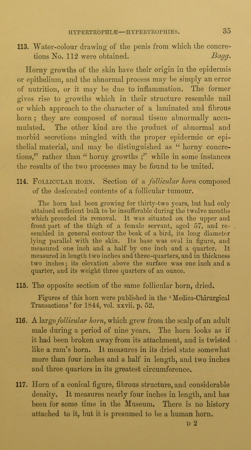 113. Water-colour drawing of the penis from which the concre- tions No. 112 were obtained. Bagg. Horny growths of the skin have their origin in the epidermis or epithelium, and the abnormal process may be simply an error of nutrition, or it may be due to inflammation. The former gives rise to growths which in their structure resemble nail or wliich approach to the character of a laminated and fibrous horn ; they are composed of normal tissue abnormally accu- mulated. The other kind are the product of abnormal and morbid secretions mingled with the proper epidermic or epi- thehal material, and may be distinguished as horny concre- tions,^’ rather than horny growths while in some instances the results of the two processes may be found to he united. 114. Follicular horn. Section of a follicular horn composed of the desiccated contents of a follicular tumour. The horn had been growing for thirty-two years, but had only attained sufficient bulk to be insufferable during the twelve months which preceded its removal. It was situated on the upper and front part of the thigh of a female servant, aged 57, and re- sembled in general contour the beak of a bird, its long diameter lying parallel with the skin. Its base was oval in figure, and measured one inch and a half by one inch and a quarter. It measured in length two inches and three-quarters, and in thickness two inches; its elevation above the surface was one inch and a quarter, and its weight three quarters of an ounce. 115. The opposite section of the same follicular horn, dried. Figures of this horn were published in the ‘ Medico-Chirurgical Transactions ’ for 1844, vol. xxvii. p. 52. 116. A large follicular horn, which grew from the scalp of an adult male during a period of nine years. The horn looks as if it had been broken away from its attachment, and is twisted like a ram’s horn. It measures in its dried state somewhat more than four inches and a half in length, and two inches and three quarters in its greatest circumference. 117. Horn of a conical figure, fibrous structure, and considerable density. It measures nearly four inches in length, and has been for some time in the Museum. There is no history attached to it, but it is presumed to ho a human horn. D 2