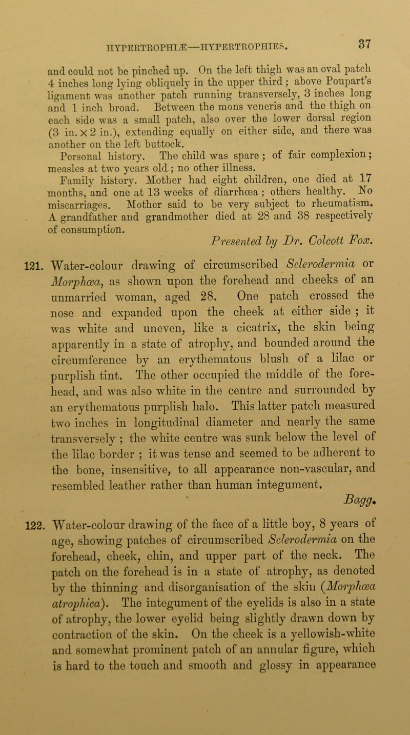 and could not bo pinched up. On the loft thigh was an oval patch 4 inches long lying obliquely in the upper third; above Pouparts ligament was another patch running transversely, 3 inches long and 1 inch broad. Between the mens veneris and the thigh on each side was a small patch, also over the lower dorsal region (3 in. X 2 in.), extending equally on either side, and there was another on the left buttock. Personal history. The child was spare ; of fair complexion ; measles at two years old; no other illness. Pamily history. Mother had eight children, one died at 17 months, and one at 13 weeks of diarrhoea; others healthy. No miscarriages. Mother said to be very subject to rheumatism. A grandfather and grandmother died at 28 and 38 respectively of consumption. Presented hy Dr. Colcott Fox. 121. Water-colour drawing of circumscribed Sclerodermia or Morphcea, as shown upon the forehead and cheeks of an unmarried woman, aged 28. One patch crossed the nose and expanded upon the cheek at either side ; it was white and uneven, like a cicatrix, the skin being apparently in a state of atrophy, and bounded around the circumference by'- an erythematous blush of a lilac or purplish tint. The other occupied the middle of the fore- head, and was also w'hite in the centre and surrounded by an erythematous purplish halo. This latter patch measured two inches in longitudinal diameter and nearly the same transversely ; the white centre was sunk below the level of the lilac border ; it was tense and seemed to be adherent to the bone, insensitive, to all appearance non-vascular, and resembled leather rather than human integument. Bagg. 122. Water-colour drawing of the face of a little boy, 8 years of age, showing patches of circumscribed Sclerodermia on the forehead, cheek, chin, and upper part of the neck. The patch on the forehead is in a state of atrophy, as denoted by the thinning and disorganisation of the skin (^Morphoea atrophica). The integument of the eyelids is also in a state of atrophy, the lower eyelid being slightly drawn down by contraction of the skin. On the cheek is a yellowish-white and somewhat prominent patch of an annular figure, which is hard to the touch and smooth and glossy in appearance