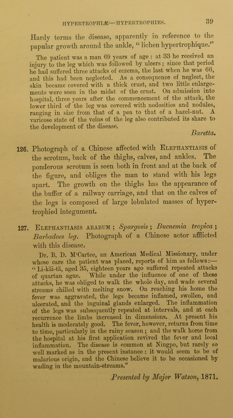 o9 Hardy terms the disease, apparently in reference to the papular growth around the ankle, lichen hypertrophique/ The patient was a man 69 years of age : at 33 he received an injury to the leg which was followed by ulcers; since that period he had suffered three attacks of eczema, the last when he was 66, and this had been neglected. As a consequence of neglect, the skin became covered with a thick crust, and two little enlarge- ments were seen in the midst of the crust. On admission into hospital, three years after the commencement of the attack, the lower third of the leg was covered with nodosities and nodules, ranging in size from that of a pea to that of a hazel-nut. A varicose state of the veins of the leg also contributed its share to the development of the disease. Baretta, 126. Photograph of a Chinese affected with Elephantiasis of the scrotum, back of the thighs, calves, and ankles. The ponderous scrotum is seen both in front and at the back of the figure, and obliges the man to stand with his legs apart. The growth on the thighs has the appearance of the buffer of a railway carriage, and that on the calves of the legs is composed of large lobulated masses of hyper- trophied integument. 127. Elephantiasis arabum ; Spargosis ; Buenemia trojnea ; Barhadoes leg. Photograph of a Chinese actor afflicted with this disease. Dr. B. D. M‘Cartee, an American Medical Missionary, under whose care the patient was placed, reports of him as follows:— “ Li-kai-ta, aged 35, eighteen years ago suffered repeated attacks of quartan ague. While under the influence of one of these attacks, he was obliged to walk the whole day, and wade several streams chilled with melting snow. On reaching his home the fever was aggravated, the legs became inflamed, swollen, and ulcerated, and the inguinal glands enlarged. The inflammation of the legs was subsequently repeated at intervals, and at each recurrence the limbs increased in dimensions. At present his health is moderately good. The fever, however, returns from time to time, particularly in the rainy season ; and the walk home from the hospital at his first application revived the fe\or and local inflammation. The disease is common at Ningpo, but rarely so well marked as in the present instance : it would seem to bo of malarious origin, and the Chinese behove it to be occasioned by wading in the mountain-streams.” Presented hy Major Watson^ 1871.