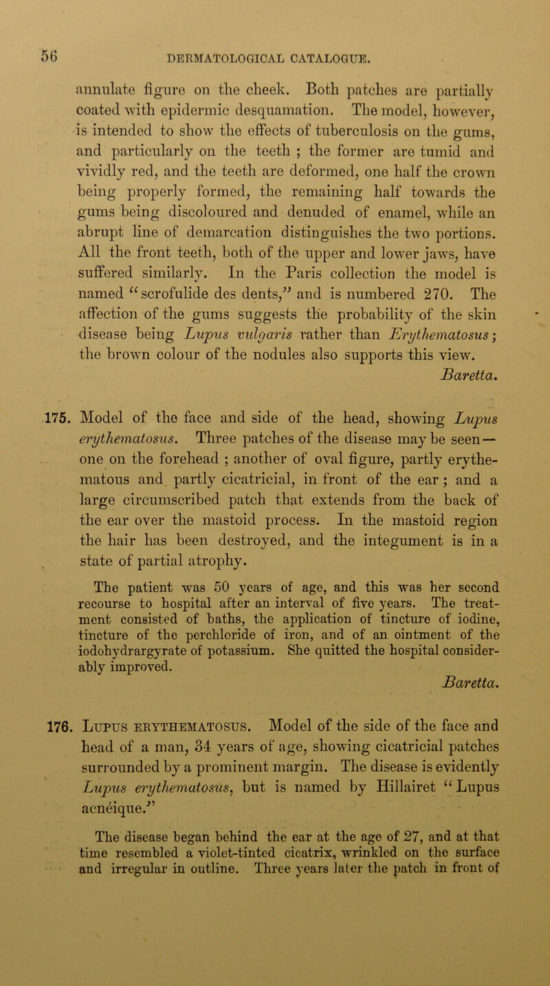 annulate figure on the cheek. Both patches are partially coated with epidermic desquamation. The model, however, is intended to show the effects of tuberculosis on the gums, and particularly on the teeth ; the former are tumid and vividly red, and the teeth are deformed, one half the crown being properly formed, the remaining half towards the gums being discoloured and denuded of enamel, while an abrupt line of demarcation distinguishes the two portions. All the front teeth, both of the upper and lower jaw^s, have sufiFered similarly. In the Paris collection the model is named “scrofulide des dents,^^ and is numbered 270. The affection of the gums suggests the probability of the skin - disease being Lupus vulgaris rather than Erythematosus] the brown colour of the nodules also supports this view. Baretta» 175. Model of the face and side of the head, showing Lupus erythematosus. Three patches of the disease maybe seen — one on the forehead ; another of oval figure, partly erythe- matous and partly cicatricial, in front of the ear; and a large circumscribed patch that extends from the back of the ear over the mastoid process. In the mastoid region the hair has been destroyed, and the integument is in a state of partial atrophy. The patient was 50 years of age, and this was her second recourse to hospital after an interval of five years. The treat- ment consisted of baths, the application of tincture of iodine, tincture of the perchloride of iron, and of an ointment of the iodohydrargyrate of potassium. She quitted the hospital consider- ably improved. Baretta. 176. Lupus erythematosus. Model of the side of the face and head of a man, 34 years of age, showing cicatricial patches surrounded by a prominent margin. The disease is evidently Jjupus erythematosus, but is named by Hillairet “ Lupus acneique.'” The disease began behind the ear at the age of 27, and at that time resembled a violet-tinted cicatrix, wrinkled on the surface and irregular in outline. Three years later the patch in front of