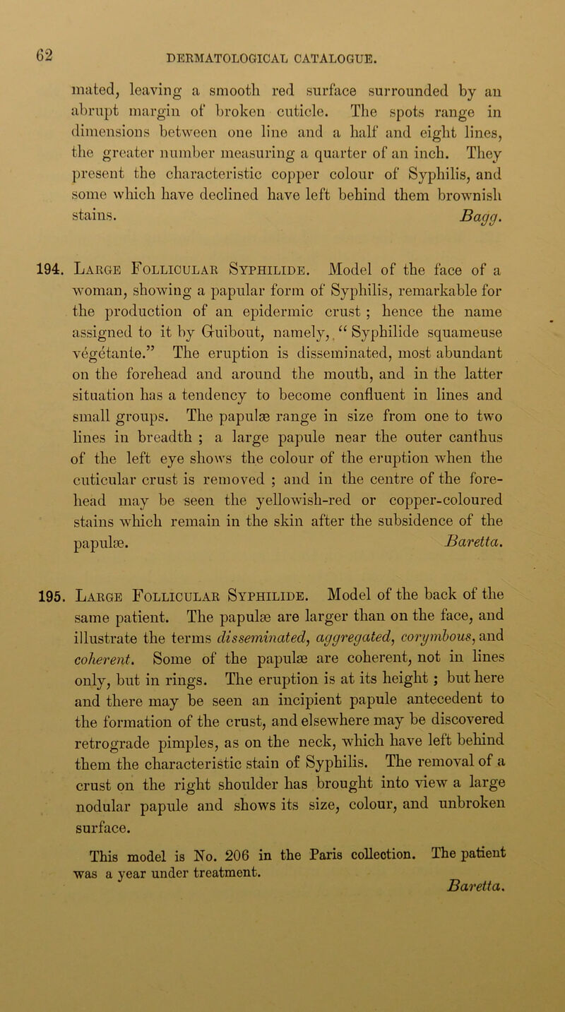 mated, leaving a smooth red surface surrounded by au abrupt margin of broken cuticle. The spots range in dimensions between one line and a half and eight lines, the greater number measuring a quarter of an inch. They present the characteristic copper colour of Syphilis, and some vvhich have declined have left behind them brownish stains. Bagg. 194. Large Follicular Syphilide. Model of the face of a woman, showing a papular form of Syphilis, remarkable for the production of an epidermic crust ; hence the name assigned to it by Griiibout, namely,. “ Syphilide squameuse vegetante.” The eruption is disseminated, most abundant on the forehead and around the mouth, and in the latter situation has a tendency to become confluent in. lines and small groups. The papulas range in size from one to two lines in breadth ; a large papule near the outer canthus of the left eye shows the colour of the eruption when the cuticular crust is removed ; and in the centre of the fore- head may be seen the yellowish-red or copper-coloured stains which remain in the skin after the subsidence of the papulae. Baretta. 195. Large Follicular Syphilide. Model of the back of the same patient. The papulae are larger than on the face, and illustrate the terms disseminated, aggregated, corynihous, and coherent. Some of the papulae are coherent, not in lines only, but in rings. The eruption is at its height; but here and there may be seen an incipient papule antecedent to the formation of the crust, and elsewhere may be discovered retrograde pimples, as on the neck, which have left behind them the characteristic stain of Syphilis. The removal of a crust on the right shoulder has brought into view a large nodular papule and shows its size, colour, and unbroken surface. This model is No. 206 in the Paris collection. The patient was a year under treatment. Baretta.