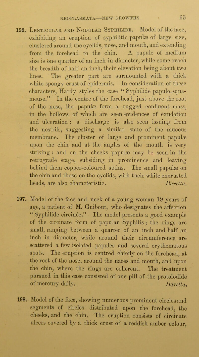 196. Lenticular and Nodular Syphilide. Model of tlie face, exhibiting an eruption of syphilitic papulfe of large size, clustered around the eyelids, nose, and mouth, and extending from the forehead to the chin. A papule of medium size is 'one quarter of an inch in diameter, while some reach the breadth of half an inch, their elevation being about two lines. The greater part are surmounted with a thick white spongy crust of epidermis. In consideration of these characters. Hardy styles the case “ Syphilide papulo-squa- nieuse.^’ In the centre of the forehead, just above the root of the nose, the papulae form a rugged confluent mass, in the hollows of which are seen evidences of exudation and ulceration : a discharge is also seen issuing from the nostrils, suggesting a similar state of the mucous membrane. The cluster of large and prominent papulae upon the chin and at the angles of the mouth is very striking ; and on the cheeks papulae may be seen in the retrograde stage, subsiding in prominence and leaving behind them copper-coloured stains. The small papulae on the chin and those on the eyelids, with their white encrusted heads, are also characteristic. Baretta. 197. Model of the face and neck of a young woman 19 years of age, a patient of M. Guibout, who designates the affection “ Syphilide circinee.’’ The model presents a good example of the circinate form of papular Syphilis ; the rings are small, ranging between a quarter of an inch and half an inch in diameter, while around their circumference are scattered a few isolated papules and several erythematous spots. The eruption is centred chiefly on the forehead, at the root of the nose, around the nares and mouth, and upon the chin, where the rings are coherent. The treatment pursued in this case consisted of one pill of the protoiodide of mercury daily. Baretta, 198. Model of the face, showing numerous prominent circles and segments of circles distributed upon the forehead, the cheeks, and the chin. The eruption consists of circinate ulcers covered by a thick crust of a reddish amber colour,