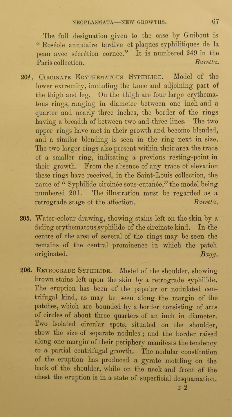 The full designation given to the case by Guibout is ‘‘ Roseole anmilaire tardive et plaques syphilitiques de la peau avec secretion cornee.” It is numbered 249 in the Paris collection. Baretta. , CiRCiNATE Erythematous Syphiltde. Model of the lower extremity, including the knee and adjoining part of the thigh and leg. On the thigh are four large erythema- tous rings, ranging in diameter between one inch and a quarter and nearly three inches, the border of the rings haviim a breadth of between two and. three lines. The two O upper rings have met in their growth and become blended, and a similar blendino; is seen in the ring next in size. The two larger rings also present within their area the trace of a smaller ring, indicating a previous resting-point in their growth. From the absence of any trace of elevation these rings have received, in the Saint-Louis collection, the name of Syphilide circinee sous-cutanee,^^ the model being numbered 201. The illustration must be regarded as a retrograde stage of the affection. Baretta. 205. Water-colour drawing, showing stains left on the skin by a fading erythematous syphilide of the circinate Idnd. In the centre of the area of several of the rings may be seen the remains of the central prominence in which the patch originated. Bagg. 206. Retrograde Syphilide. Model of the shoulder, showing brown stains left upon the skin by a retrograde syphilide. The eruption has been of the papular or nodulated cen- trifugal kind, as may be seen along the margin of the patches, which are bounded by a border consisting of arcs of circles of about three quarters of an inch in diameter. Two isolated circular spots, situated on the shoulder, show the size of separate nodules ; and the border raised along one margin of their periphery manifests the tendency to a partial centrifugal growth. The nodular constitution of the eruption has produced a gyrate mottling on the back of the shoulder, while on the neck and front of the chest the eruption is in a state of superficial desquamation. F 2