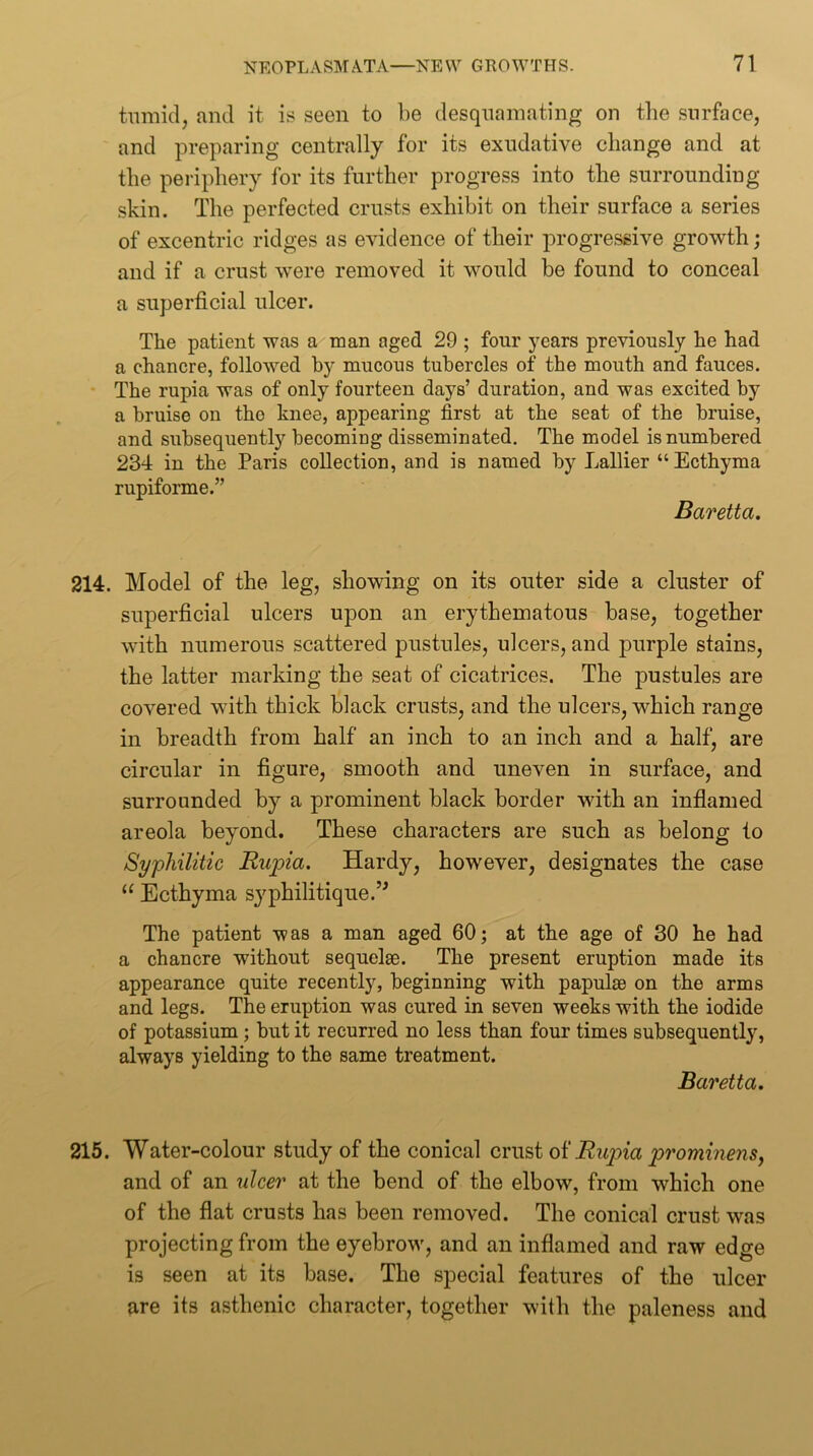 tRmicl, and it is seen to be desquamating on tlie surface, and preparing centrally for its exudative change and at the periphery for its further progress into the surrounding- skin. The perfected crusts exhibit on their surface a series of excentric ridges as evidence of their progressive growth; and if a crust were removed it would he found to conceal a superficial ulcer. The patient was a man aged 29 ; four years previously he had a chancre, followed by mucous tubercles of the mouth and fauces. ■ The rupia was of only fourteen days’ duration, and was excited by a bruise on the knee, appearing first at the seat of the bruise, and subsequently becoming disseminated. The model is numbered 234 in the Paris collection, and is named by Lallier “Ecthyma rupiforme.” Baretta. 214. Model of the leg, showing on its outer side a cluster of superficial ulcers upon an erythematous base, together with numerous scattered pustules, ulcers, and purple stains, the latter marking the seat of cicatrices. The pustules are covered with thick black crusts, and the ulcers, which range in breadth from half an inch to an inch and a half, are circular in figure, smooth and uneven in surface, and surrounded by a prominent black border -with an inflamed areola beyond. These characters are such as belong to Syphilitic Rupia. Hardy, however, designates the case “ Ecthyma syphilitique.’^ The patient was a man aged 60; at the age of 30 he had a chancre without sequelse. The present eruption made its appearance quite recently, beginning with papulae on the arms and legs. The eruption was cured in seven weeks with the iodide of potassium; but it recurred no less than four times subsequent!}', always yielding to the same treatment. Baretta. 215. Water-colour study of the conical crust Rujjia prominensy and of an \dcer at the bend of the elbow, from which one of the flat crusts has been removed. The conical crust was projecting from the eyebrow, and an inflamed and raw edge is seen at its base. The special features of the ulcer are its asthenic character, together with the paleness and
