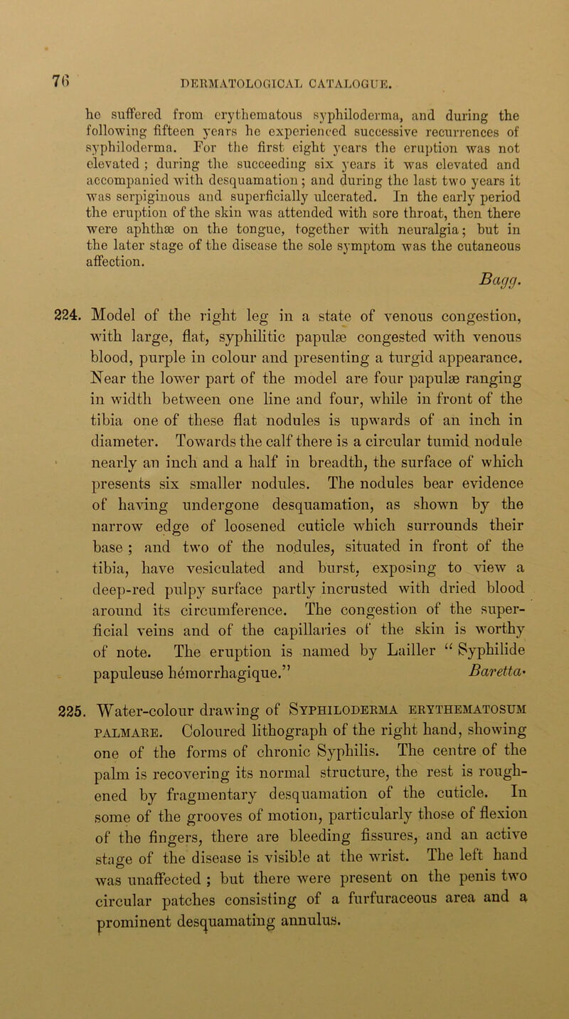 7(1 ho sufFerecI from erythematous syphiloderma, and during the following fifteen years he experienced successive recurrences of syphiloderma. For the first eight years the eruption was not elevated ; during the succeeding six years it was elevated and accompanied with desquamation; and during the last two years it was serpiginous and superficially ulcerated. In the early period the eruption of the skin was attended with sore throat, then there were aphthae on the tongue, together with neuralgia; hut in the later stage of the disease the sole symptom was the cutaneous affection. 224. Model of the right leg in a state of venous congestion, with large, flat, syphilitic papulae congested with venous blood, purple in colour and presenting a turgid appearance. Near the lower part of the model are four papulae ranging in width between one line and four, while in front of the tibia one of these flat nodules is upwards of an inch in diameter. Towards the calf there is a circular tumid nodule ' nearly an inch and a half in breadth, the surface of which t/ ' presents six smaller nodules. The nodules bear evidence of having undergone desquamation, as shown by the narrow edge of loosened cuticle which surrounds their base ; and two of the nodules, situated in front of the tibia, have vesiculated and burst, exposing to view a deep-red pulpy'' surface partly incrusted with dried blood around its circumference. The congestion of the super- ficial veins and of the capillaries of the skin is worthy of note. The eruption is named by Lailler “ ^yphilide papuleuse hemorrhagique.” Baretta> 225. Water-colour drawing of Syphiloderma erythematosum PALMARE. Coloured lithograph of the right hand, showing one of the forms of chronic Syphilis. The centre of the palm is recovering its normal structure, the rest is rough- ened by fragmentary desquamation of the cuticle. In some of the grooves of motion, particularly those of flexion of the fingers, there are bleeding fissures, and an active stage of the disease is visible at the wrist. The left hand was unaffected ; but there were present on the penis tw'o circular patches consisting of a furfuraceous area and a prominent des(|uamating annulus.