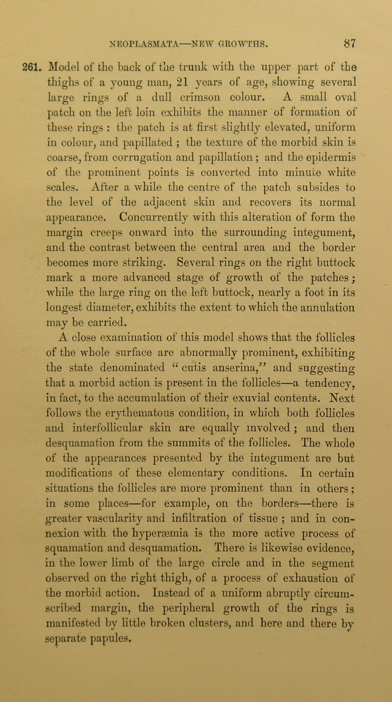 261, Model of the back of the trunk with the upper part of the thighs of a young man, 21 years of age, showing several lar^e rings of a dull crimson colour. A small oval patch on the left loin exhibits the manner of formation of these rings : the patch is at first slightly elevated, uniform in colour, and papillated ; the texture of the morbid skin is coarse, from corrugation and papillation; and the epidermis of the prominent points is converted into minute white scales. After a while the centre of the patch subsides to the level of the adjacent skin and recovers its normal appearance. Concurrently with this alteration of form the margin creeps onward into the surrounding integument, and the contrast between the central area and the border becomes more striking. Several rings on the right buttock mark a more advanced stage of growth of the patches; while the large ring on the left buttock, nearly a foot in its longest diameter, exhibits the extent to which the annulation may be carried. A close examination of this model shows that the follicles of the whole surface are abnormally prominent, exhibiting the state denominated cutis anserina,’^ and suggesting that a morbid action is present in the follicles—a tendency, in fact, to the accumulation of their exuvial contents. Next follows the erythematous condition, in which both follicles and interfollicular skin are equally involved ; and then desquamation from the summits of the follicles. The whole of the appearances presented by the integument are but modifications of these elementary conditions. In certain situations the follicles are more prominent than in others ; in some places—for example, on the borders—there is greater vascularity and infiltration of tissue ; and in con- nexion with the hypergemia is the more active process of squamation and desquamation. There is likewise evidence, in the lower limb of the large circle and in the segment observed on the right thigh, of a process of exhaustion of the morbid action. Instead of a uniform abruptly circum- scribed margin, the peripheral growth of the rings is manifested by little broken clusters, and here and there by separate papules.
