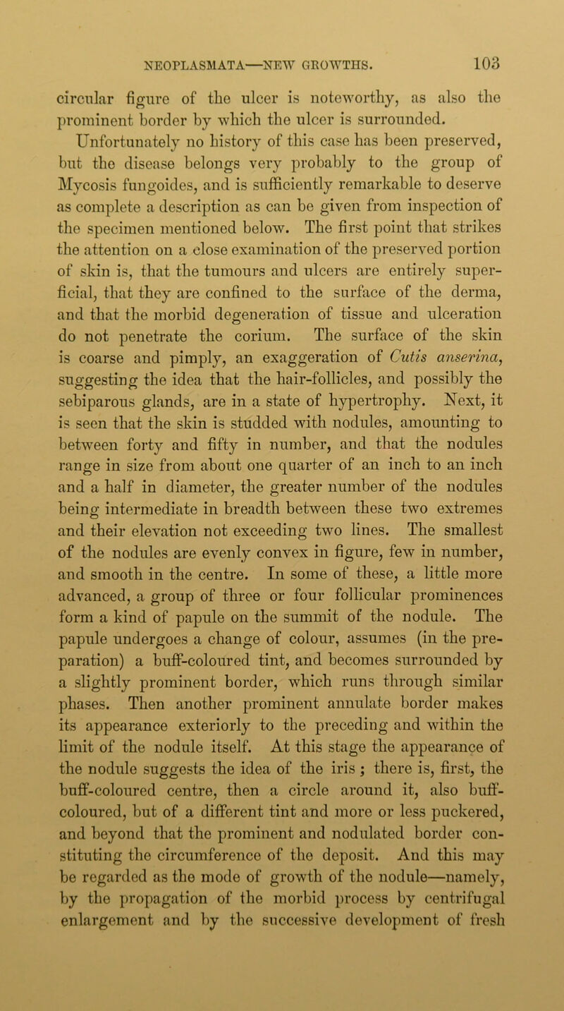 circular figure of the ulcer is noteworthy, as also the prominent border by which the ulcer is surrounded. Unfortunately no history of this case has been preserved, but the disease belongs very probably to the group of Mycosis fungoides, and is sufficiently remarkable to deserve as complete a description as can be given from inspection of the specimen mentioned below. The first point that strikes the attention on a close examination of the preserved portion of skin is, that the tumours and ulcers are entirely super- ficial, that they are confined to the surface of the derma, and that the morbid degeneration of tissue and ulceration do not penetrate the coriuin. The surface of the skin is coarse and pimply, an exaggeration of Cutis anserina, suggesting the idea that the hair-follicles, and possibly the sebiparous glands, are in a state of hypertrophy. Next, it is seen that the skin is studded with nodules, amounting to between forty and fifty in number, and that the nodules range in size from about one quarter of an inch to an inch and a half in diameter, the greater number of the nodules being intermediate in breadth between these two extremes and their elevation not exceeding two lines. The smallest of the nodules are evenly convex in figure, few in number, and smooth in the centre. In some of these, a little more advanced, a group of three or four follicular prominences form a kind of papule on the summit of the nodule. The papule undergoes a change of colour, assumes (in the pre- paration) a buff-coloured tint, and becomes surrounded by a slightly prominent border, which runs through similar phases. Then another prominent annulate border makes its appearance exteriorly to the preceding and within the limit of the nodule itself. At this stage the appearance of the nodule suggests the idea of the iris; there is, first, the buff-coloured centre, then a circle around it, also buff- coloured, but of a different tint and more or less puckered, and beyond that the prominent and nodulated border con- stituting the circumference of the deposit. And this may be regarded as the mode of growth of the nodule—namely, by the propagation of the morbid process by centrifugal enlargement and by the successive development of fresh