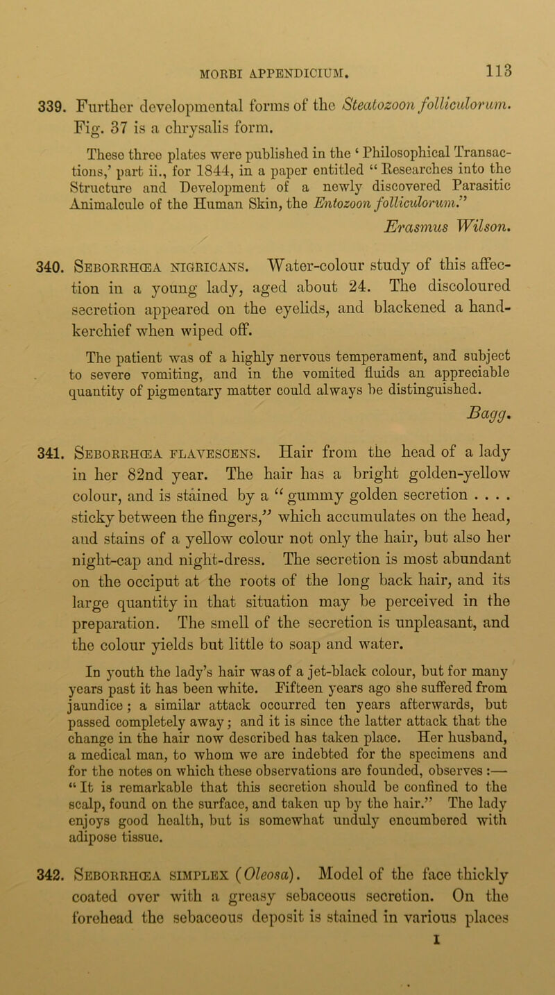 339. Further developmental forms of the Steatozoon follicidorum. Fig. 37 is a chrysalis form. These three plates were published in the ‘ Philosophical Transac- tions,’ part ii., for 1844, in a paper entitled “ Fesearches into the Structure and Development of a newly discovered Parasitic Animalcule of the Human Skin, the Entozoon folliculorum.” Erasmus Wilson* 340. Seborrhcea nigricans. Water-colour study of this affec- tion in a young lady, aged about 24. The discoloured secretion appeared on the eyelids, and blackened a hand- kerchief when wiped oflF. The patient was of a highly nervous temperament, and subject to severe vomiting, and in the vomited fluids an appreciable quantity of pigmentary matter could always be distinguished. Baejg, 341. Seborrhcea flavescens. Hair from the head of a lady in her 82nd year. The hair has a bright golden-yellow colour, and is stained by a gummy golden secretion . . . . sticky between the fingers,’^ which accumulates on the head, and stains of a yellow colour not only the hair, but also her night-cap and night-dress. The secretion is most abundant on the occiput at the roots of the long back hair, and its large quantity in that situation may be perceived in the preparation. The smell of the secretion is unpleasant, and the colour yields but little to soap and water. In youth the lady’s hair was of a jet-black colour, but for many years past it has been white. Fifteen years ago she suffered from jaundice ; a similar attack occurred ten years afterwards, but passed completely away; and it is since the latter attack that the change in the hair now described has taken place. Her husband, a medical man, to whom we are indebted for the specimens and for the notes on which these observations are founded, observes :— “ It is remarkable that this secretion should be confined to the scalp, found on the surface, and taken up by the hair.” The lady enjoys good health, but is somewhat unduly encumbered with adipose tissue. 342. Seborrhcea simplex (Oleosa). Model of the face thickly coated over with a greasy sebaceous secretion. On the forehead the sebaceous deposit is stained in various places 1