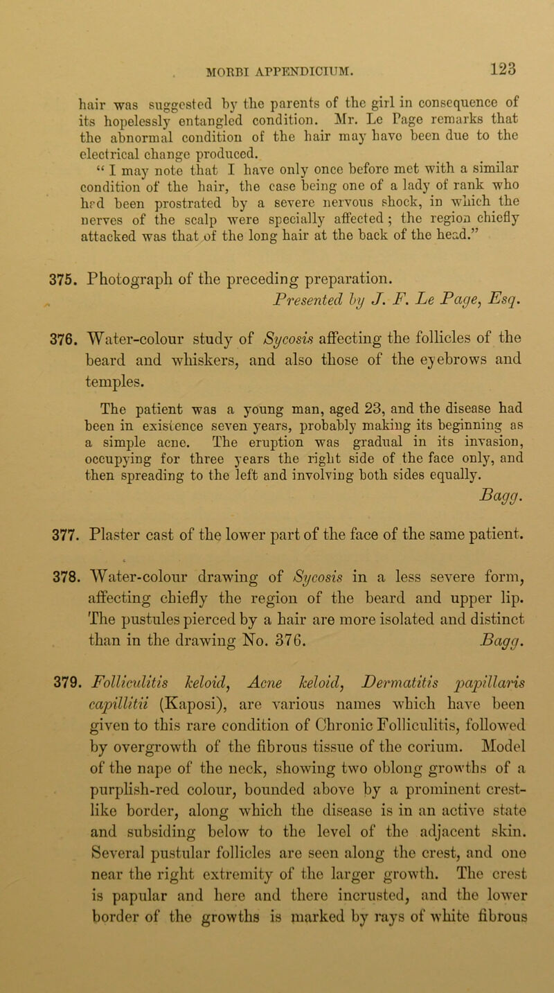 hair was suggested by the parents of the girl in consequence of its hopelessly entangled condition. Mr. Le Page remarks that the abnormal condition of the hair may have been due to the electrical change produced. “ I may note that I have only once before met with a similar condition of the hair, the case being one of a lady of rank who hrd been prostrated by a severe nervous shock, in which the nerves of the scalp were specially affected ; the region chiefly attacked was that of the long hair at the back of the head.” 375. Photograph of the preceding preparation. . Presented hy J. F. Le Page^ Esq. 376. Water-colour study of Sycosis affecting the follicles of the beard and whiskers, and also those of the eyebrows and temples. The patient was a young man, aged 23, and the disease had been in existence seven years, probably making its beginning as a simple acne. The eruption was gradual in its invasion, occupying for three years the right side of the face only, and then spreading to the left and involving both sides equally. Bagej. 377. Plaster cast of the lower part of the face of the same patient. 378. Water-colour drawing of Sycosis in a less severe form, affecting chiefly the region of the heard and upper lip. The pustules pierced by a hair are more isolated and distinct than in the drawing No. 376. Bagg. 379. Folliciditis keloid, Acne keloid, Dermatitis qjapillaHs capillitii (Kaposi), are various names which have been given to this rare condition of Chronic Folliculitis, followed by overgrowth of the fibrous tissue of the corium. Model of the nape of the neck, showing two oblong growths of a purplish-red colour, bounded above hy a prominent crest- like border, along which the disease is in an active state and subsiding below to the level of the adjacent skin. Several pustular follicles are seen along the crest, and one near the right extremity of the larger growth. The crest is papular and here and there incrusted, and the lower border of the growths is marked by rays of white fibrous