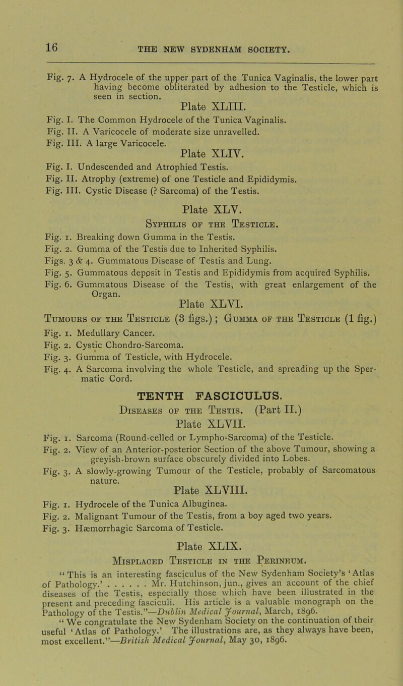 Fig. 7. A Hydrocele of the upper part of the Tunica Vaginalis, the lower part having become obliterated by adhesion to the Testicle, which is seen in section. Plate XLIII. Fig. I. The Common Hydrocele of the Tunica Vaginalis. Fig. II. A Varicocele of moderate size unravelled. Fig. HI. A large Varicocele. Plate XLIV. Fig. I. Undescended and Atrophied Testis. Fig. II. Atrophy (extreme) of one Testicle and Epididymis. Fig. III. Cystic Disease (? Sarcoma) of the Testis. Plate XLV. Syphilis op the Testicle. Fig. I. Breaking down Gumma in the Testis. Fig. 2. Gumma of the Testis due to Inherited Syphilis. Figs. 3 & 4. Gummatous Disease of Testis and Lung. Fig. 5. Gummatous deppsit in Testis and Epididymis from acquired Syphilis. Fig. 6. Gummatous Disease of the Testis, with great enlargement of the Organ. Plate XLVI. Tumours of the Testicle (3 figs.); Gumma op the Testicle (1 fig.) Fig. I. Medullary Cancer. Fig. 2. Cystic Chondro-Sarcoma. Fig. 3. Gumma of Testicle, with Hydrocele. Fig. 4. A Sarcoma involving the whole Testicle, and spreading up the Sper- matic Cord. TENTH FASCICULUS. Diseases of the Testis. (Part II.) Plate XLVII. Fig. I. Sarcoma (Round-celled or Lympho-Sarcoma) of the Testicle. Fig. 2. View of an Anterior-posterior Section of the above Tumour, showing a greyish-brown surface obscurely divided into Lobes. Fig. 3. A slowly-growing Tumour of the Testicle, probably of Sarcomatous nature. Plate XLVIII. Fig. I. Hydrocele of the Tunica Albuginea. Fig. 2. Malignant Tumour of the Testis, from a boy aged two years. Fig. 3. Hasmorrhagic Sarcoma of Testicle. Plate XLIX. Misplaced Testicle in the Perineum. “This is an interesting fasciculus of the New Sydenham Society’s ‘Atlas of Pathology.’ Mr. Hutchinson, jun., gives an account of the chief diseases of the Testis, especially those which have been illustrated in the present and preceding fasciculi. His article is a valuable monograph on the Pathology of the Testis.”—Dublin Medical Journal, March, 1896. “ We congratulate the New Sydenham Society on the continuation of their useful ‘Atlas of Pathology.’ The illustrations are, as they always have been, most excellent.”—British Medical Journal, May 30, 1896.