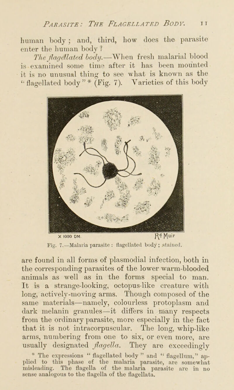 human body ; and, third, how does the parasite enter the human body 1 The flagellated body.—When fresh malarial blood is examined some time after it has been mounted it is no unusual thing to see what is known as the £; flagellated body”* (Fig. 7). Varieties of this body X 1000 DM fV Muir Fig. 7.—Malaria parasite : flagellated body; stained. are found in all forms of plasmodial infection, both in the corresponding parasites of the lower warm-blooded animals as wrnll as in the forms special to man. It is a strange-looking, octopus-like creature with long, actively-moving arms. Though composed of the same materials—namely, colourless protoplasm and dark melanin granules—it differs in many respects from the ordinary parasite, more especially in the fact that it is not intracorpuscular. The long, whip-like arms, numbering from one to six, or even more, are usually designated flagella. They are exceedingly * The expressions “ flagellated body ” and “ flagellum,” ap- plied to this phase of the malaria parasite, are somewhat misleading. The flagella of the malaria parasite are in no sense analogous to the flagella of the flagellata.