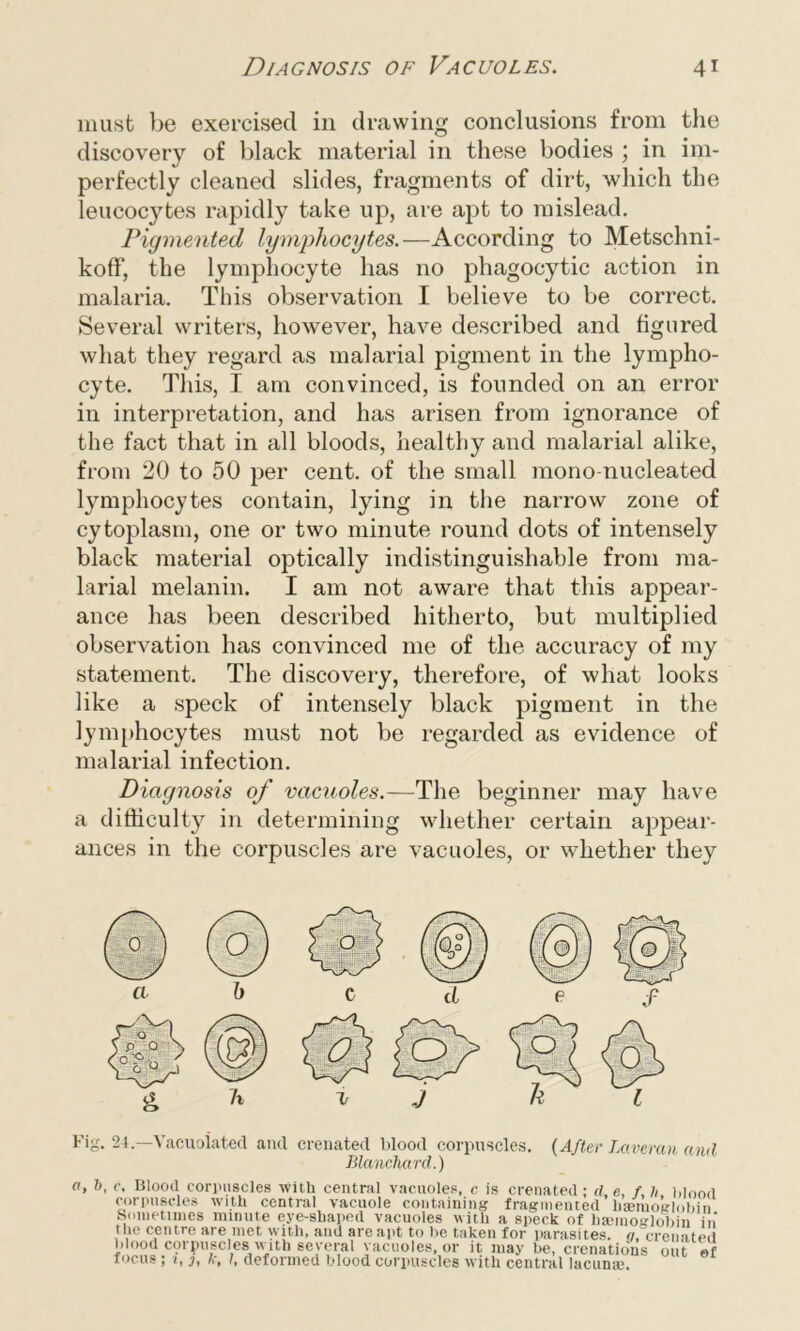 must be exercised in drawing conclusions from the discovery of black material in these bodies ; in im- perfectly cleaned slides, fragments of dirt, which the leucocytes rapidly take up, are apt to mislead. Pigmented lymphocytes.—According to Metschni- koff, the lymphocyte has no phagocytic action in malaria. This observation I believe to be correct. Several writers, however, have described and figured what they regard as malarial pigment in the lympho- cyte. This, I am convinced, is founded on an error in interpretation, and has arisen from ignorance of the fact that in all bloods, healthy and malarial alike, from 20 to 50 per cent, of the small mono nucleated lymphocytes contain, lying in the narrow zone of cytoplasm, one or two minute round dots of intensely black material optically indistinguishable from ma- larial melanin. I am not aware that this appear- ance has been described hitherto, but multiplied observation has convinced me of the accuracy of my statement. The discovery, therefore, of what looks like a speck of intensely black pigment in the lymphocytes must not be regarded as evidence of malarial infection. Diagnosis of vacuoles.—The beginner may have a difficulty in determining whether certain appear- ances in the corpuscles are vacuoles, or whether they Fig. 24.—Vacuolated and crenated blood corpuscles. {After Laveran and Blanchard.)