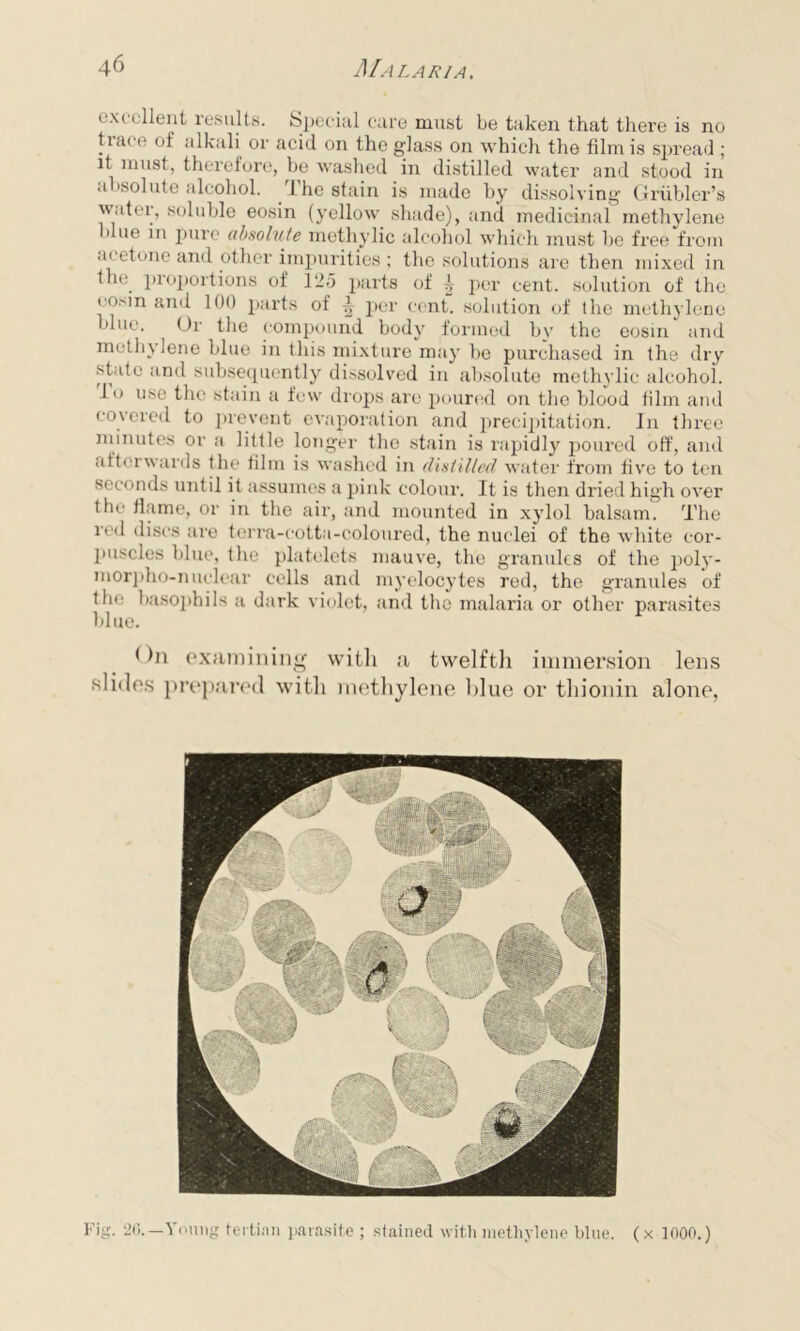 excellent results. Special care must be taken that there is no hare of alkali or acid on the glass on which the film is spread ; it must, therefore, be washed in distilled water and stood in absolute alcohol. The stain is made by dissolving Griibler’s water, soluble eosin (yellow shade), and medicinal methylene blue m pure absolute methylic alcohol which must be free from .m etone and other impurities ; the solutions are then mixed in the. proportions of 125 parts of ^ per cent, solution of the eosin and 100 parts of ^ per cent, solution of the methylene blue. Ur the compound body formed by the eosin and methylene blue in this mixture may be purchased in the dry state and subsequently dissolved in absolute methylic aleohoi. do use the stain a few drops are poured on the blood film and covered to prevent evaporation and precipitation. In three minutes or a little longer the stain is rapidly poured off, and afterwards the film is washed in distilled water from five to ten seconds until it assumes a pink colour. It is then dried high over the flame, or in the air, and mounted in xylol balsam. The rod discs are terra-cotta-coloured, the nuclei of the white cor- puscles blue, the platelets mauve, the granules of the polj'- morpho-nuclear cells and myelocytes red, the granules of the basophils a dark violet, and the malaria or other parasites blue. < )n examining witli a twelfth immersion lens slides prepared with methylene blue or thionin alone, Fig. 26.—Young tertian parasite ; stained with methylene blue, (x 1000.)