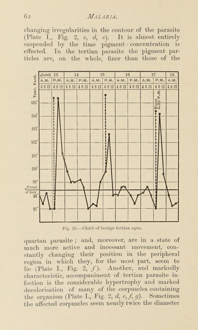 changing irregularities in the contour of the parasite (Plate I., Fig. 2, c, cl, e). It is almost entirely suspended by the time pigment - concentration is effected. In the tertian parasite the pigment par- ticles are, on the whole, finer than those of the quartan parasite ; and, moreover, are in a state of much more active and incessant movement, con- stantly changing their position in the peripheral region in which they, for the most part, seem to lie (Plate I., Fig. 2, /). Another, and markedly characteristic, accompaniment of tertian parasite in- fection is the considerable hypertrophy and marked decolorisation of many of the corpuscles containing the organism (Plate I., Fig. 2, d, e,f cj). Sometimes the affected corpuscles seem nearly twice the diameter