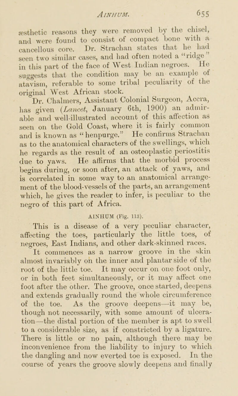 aesthetic reasons they were removed by the chisel, and were found to consist of compact bone with a cancellous core. Dr. Strachan states that he had seen two similar cases, and had often noted a Fidge in this part of the face of West Indian negroes. He suggests that the condition may be an example of atavism, referable to some tribal peculiarity of the original West African stock. Dr. Chalmers, Assistant Colonial Surgeon, Accra, has given (Lancet, January Gth, 1900) an admir- able and well-illustrated account of this aflection as seen on the Gold Coast, where it is fairly common and is known as “ henpurge.” He confirms Strachan as to the anatomical characters of the swellings, which he regards as the result of an osteoplastic periostitis due to yaws. He affirms that the morbid process begins during, or soon after, an attack of yaws, and is correlated in some way to an anatomical arrange- ment of the blood-vessels of the parts, an arrangement which, he gives the reader to infer, is peculiar to the negro of this part of Africa. AINHUM (Fig. 113). This is a disease of a very peculiar character, affecting the toes, particularly the little toes, of negroes, East Indians, and other dark-skinned races. It commences as a narrow groove in the skin almost invariably on the inner and plantar side of the root of the little toe. It may occur on one foot only, or in both feet simultaneously, or it may affect one foot after the other. The groove, once started, deepens and extends gradually round the whole circumference of the toe. As the groove deepens—it may be, though not necessarily, with some amount of ulcera- tion—the distal portion of the member is apt to swell to a considerable size, as if constricted by a ligature. There is little or no pain, although there may be inconvenience from the liability to injury to which the dangling and now everted toe is exposed. In the course of years the groove slowly deepens and finally