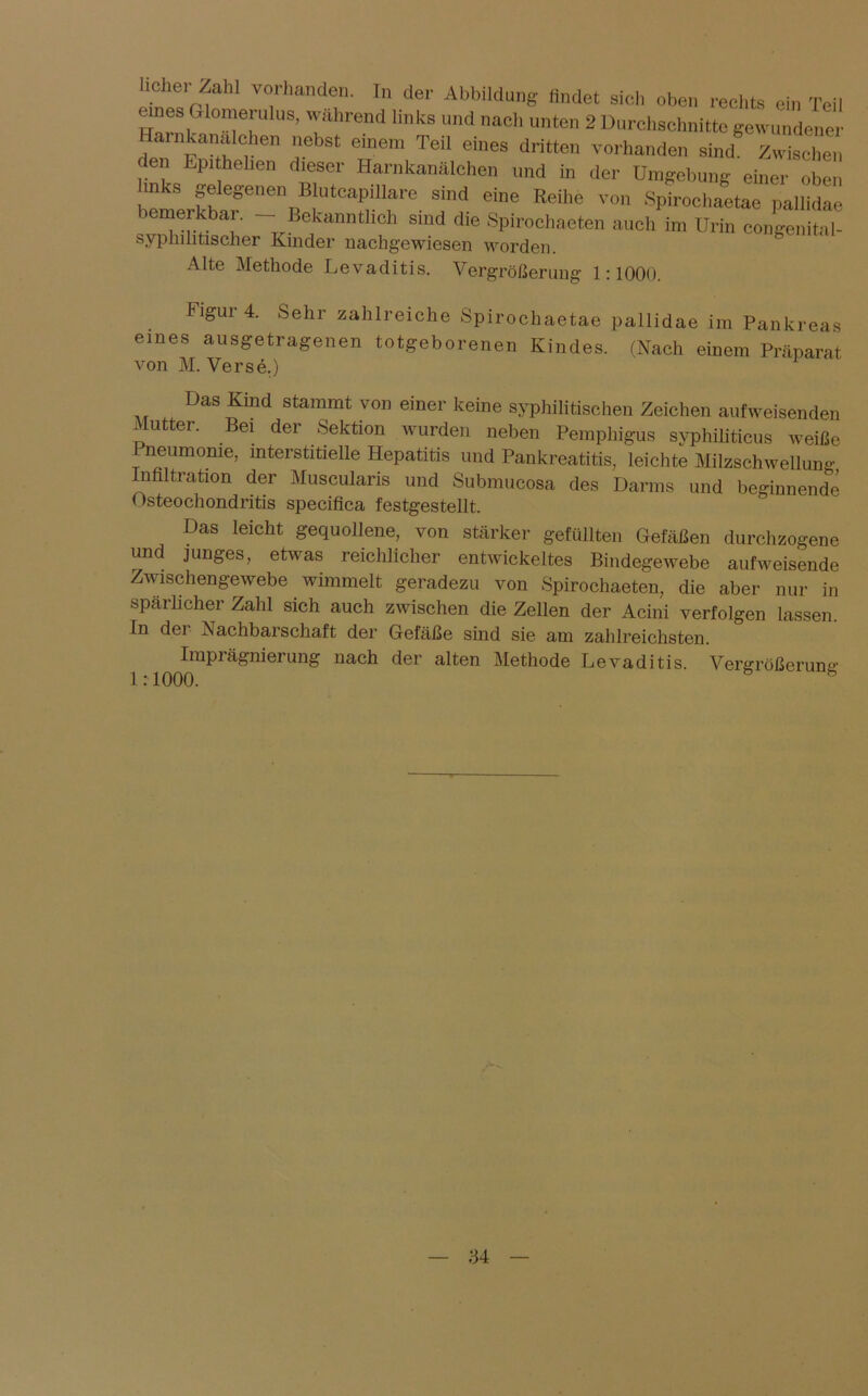 liehe.- Zahl vorhanden. In der Abbildung findet sich oben rechts ein Teil r?10™ US’ Wilhrend hnk8 und na<* unten 2 Durchschnitte gewundener Harnkanalchen nebst einem Teil eines dritten vorhanden sind Zwischen en hpithehen dieser Harnkanälchen und in der Umgebung einer oben uiks gelegenen Blutcapillare sind eine Reihe von Spirochaetae pailidae 1 merkbai. Bekanntlich sind die Spirochaeten aucli im Urin congenital- syphilitischer Kinder nachgewiesen worden. Alte Methode Levaditis. Vergrößerung- 1:1000. iigur4. Sehr zahlreiche Spirochaetae pailidae im Pankreas eines ausgetragenen totgeborenen Kindes. (Nach einem Präparat von M. Verse.) Das Kind stammt von einer keine syphilitischen Zeichen aufweisenden Mutter. Bei der Sektion wurden neben Pemphigus syphiliticus weiße Z neumome> interstitielle Hepatitis und Pankreatitis, leichte Milzschwellung nfiltration der Muscularis und Submucosa des Darms und beginnende Osteochondritis specifica festgestellt. Das leicht gequollene, von stärker gefüllten Gefäßen durchzogene und junges, etwas reichlicher entwickeltes Bindegewebe aufweisende Zwischengewebe wimmelt geradezu von Spirochaeten, die aber nur in spärlicher Zahl sich auch zwischen die Zellen der Acini verfolgen lassen. In der Nachbarschaft der Gefäße sind sie am zahlreichsten. Imprägnierung nach der alten Methode Levaditis. Vergrößerung 1:1000. ö :u