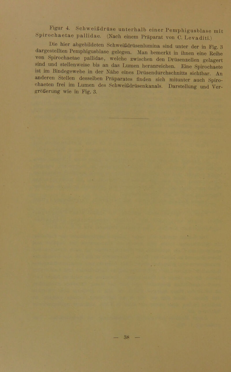 Figur 4. Schweißdrüse unterhalb einer Pemphigusblase mit Spirochaetae pallidae. (Nach einem Präparat von C. Levaditi.) Die hier abgebildeten Schweißdrüsenlumina sind unter der in Fig. 3 dargestellten Pemphigusblase gelegen. Man bemerkt in ihnen eine Reihe von Spirochaetae pallidae, welche zwischen den Drüsenzellen gelagert sind und stellenweise bis an das Lumen heranreichen. Eine Spirochaete ist im Bindegewebe in der Nähe eines Drüsendurchschnitts sichtbar. An anderen Stellen desselben Präparates finden sich mitunter auch Spiro- chaeten frei im Lumen des Schweißdrüsenkanals. Darstellung und Ver- größerung wie in Fig. 3.