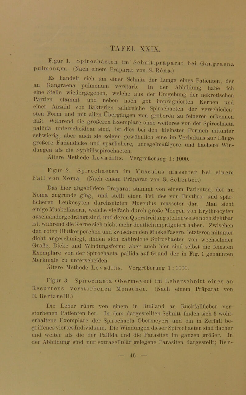 Figur 1. Spirochäeten im Schnittpräparat bei Gangraena pulmonum. (Nach einem Präparat von S. Röna.) Es handelt sich um einen Schnitt der Lunge eines Patienten, der an Gangraena pulmonum verstarb. In der Abbildung habe’ ich eine Stelle wiedergegeben, welche aus der Umgebung der nekrotischen Partien stammt und neben noch gut imprägnierten Kernen und einer Anzahl von Bakterien zahlreiche Spirochäeten der verschieden- sten Form und mit allen Übergängen von gröberen zu feineren erkennen läßt, Während die größeren Exemplare ohne weiteres von der Spirochaeta pallida unterscheidbar sind, ist dies bei den kleinsten Formen mitunter schwielig, abei auch sie zeigen gewöhnlich eine im Verhältnis zur Länge größere Fadendicke und spärlichere, unregelmäßigere und flachere Win- dungen als die Syphilisspirochaeten. Ältere Methode Levaditis. Vergrößerung 1:1000. Figur 2. Spirochäeten im Musculus masseter bei einem Fall von Noma. (Nach einem Präparat von G. Scherben.) Das hier abgebildete Präparat stammt von einem Patienten, der an Noma zugrunde ging, und stellt einen Teil des von Erythro- und spär- licheren Leukocyten durchsetzten Musculus masseter dar. Man sieht einige Muskelfasern, welche vielfach durch große Mengen von Erytlirocyten auseinandergedrängt sind, und deren Querstreifung stellenweise noch sichtbar ist, während die Kerne sich nicht mehr deutlich imprägniert haben. Zwischen den roten Blutkörperchen und zwischen den Muskelfasern, letzteren mitunter dicht angeschmiegt, finden sich zahlreiche Spirochäeten von wechselnder Größe, Dicke und Windungsform; aber auch hier sind selbst die fernsten Exemplare von der Spirochaeta pallida auf Grund der in Fig. 1 genannten Merkmale zu unterscheiden. Ältere Methode Levaditis. Vergrößerung 1 : 1000. Figur 3. Spirochaeta Obermeyeri im Leberschnitt eines an Recurrens verstorbenen Menschen. (Nach einem Präparat von E. Bertarelli.) Die Leber rührt von einem in Rußland an Rückfallfieber ver- storbenen Patienten her. In dem dargestellten Schnitt finden sich 3 wohl- erhaltene Exemplare der Spirochaeta Obermeyeri und ein in Zerfall be- griffenes viertes Individuum. Die Windungen dieser Spirochäeten sind flacher und weiter als die der Pallida und die Parasiten im ganzen größer. In der Abbildung sind nur extracellulär gelegene Parasiten dargestellt; Ber-