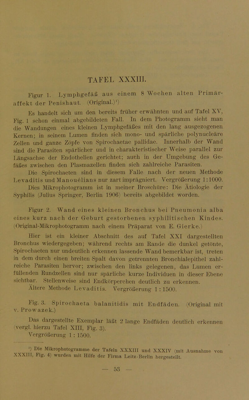 Figur 1. Lymphgefäß aus einem 8 Wochen alten Primär- affekt der Penishaut. (Original.)') Es handelt sich um den bereits früher erwähnten und auf Tafel XV, Fig. 1 schon einmal abgebildeten Fall. In dem Photogramm sieht man die Wandungen eines kleinen Lymphgefäßes mit den lang ausgezogenen Kernen; in seinem Lumen finden sich mono- und spärliche polynucleäre Zellen und ganze Zöpfe von Spirochaetae pallidae. Innerhalb der Wand sind die Parasiten spärlicher und in charakteristischer Weise parallel zur Längsachse der Endothelien gerichtet; auch in der Umgebung des Ge- fäßes zwischen den Plasmazellen finden sich zahlreiche Parasiten. Die Spirochaeten sind in diesem Falle nach der neuen Methode Levaditis und Manouelians nur zart imprägniert. Vergrößerung 1:1000. Dies Mikrophotogramm ist in meiner Broschüre: Die Ätiologie der Syphilis (Julius Springer, Berlin 1906) bereits abgebildet worden. Figur 2. Wand eines kleinen Bronchus bei Pneumonia alba eines kurz nach der Geburt gestorbenen syphilitischen Kindes. (Original-Mikrophotogramm nach einem Präparat von E. Gierke.) Hier ist ein kleiner Abschnitt des auf Tafel XXI dargestellten Bronchus wiedergegeben; während rechts am Bande die dunkel getönte, Spirochaeten nur undeutlich erkennen lassende Wand bemerkbar ist, treten in dem durch einen breiten Spalt davon getrennten Bronchialepithel zahl- reiche Parasiten hervor; zwischen den links gelegenen, das Lumen er- füllenden Rundzellen sind nur spärliche kurze Individuen in dieser Ebene sichtbar. Stellenweise sind Endkörperchen deutlich zu erkennen. Ältere Methode Levaditis. Vergrößerung 1:1500. lig. 3. Spirocliaeta balanitidis mit Endfäden. (Original mit v. Prowazek.) Das dargestellte Exemplar läßt 2 lange Endfäden deutlich erkennen (vergl. hierzu Tafel XIII, Fig. 3). Vergrößerung 1: 1500. ') Die Mikrophotogramme der Tafeln XXXIII und XXXIV (mit Ausnahme von XXXIII, Fig. 4) wurden mit Hilfe der Firma Leitz-Berlin herg’estellt.
