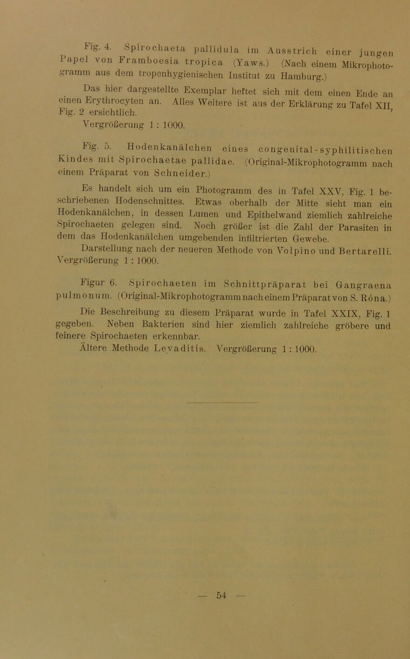 einer jungen Jng. 4. Spirocliaeta pallidula im Ausstrich jv>j ^ l'apel von Framboosia tropica (Yaws.) (Nach einem Mikrophtto- giamm aus dem tropenhygienischen Institut zu Hamburg.) Das hier dargestellte Exemplar heftet sich mit dem einen Ende an einen Erythrocyfcen an. Alles Weitere ist aus der Erklärung zu Tafel XII Fig. 2 ersichtlich. ’ Vergrößerung 1 : 1000. big. 5. Hodenkanälchen eines congenital - syphilitischen Kindes mit Spirochaetae pallidae. (Original-Mikrophotogramm nach einem Präparat von Schneider.) Es handelt sich um ein Photogramm des in Tafel XXV, Fig. 1 be- schriebenen Hodenschnittes. Etwas oberhalb der Mitte sieht man ein Hodenkanälchen, in dessen Lumen und Epithelwand ziemlich zahlreiche Spirochaeten gelegen sind. Noch größer ist die Zahl der Parasiten in dem das Hodenkanälchen umgebenden infiltrierten Gewebe. Darstellung nach der neueren Methode von Volpino und Bertarelli. Vergrößerung 1 : 1000. Figur ß. Spirochaeten im Schnittpräparat bei Gfangraena pulmonum. (Original-Mikrophotogramm nach einem Präparat von S. Röna.) Die Beschreibung zu diesem Präparat wurde in Tafel XXIX, Fig. 1 gegeben. Neben Bakterien sind hier ziemlich zahlreiche gröbere und feinere Spirochaeten erkennbar. Ältere Methode Levaditis. Vergrößerung 1 : 1000.