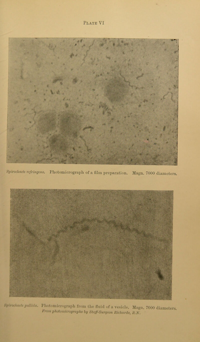 Spirochaete re/ringens. Photomicrograph of a film preparation. Magn. 7000 diameters. SpirodiucfcpalUrla. I’liotomicrograpli from (ho nuid of a vo.sielo. Magn. 7000 diameters. I'rom phutomicrographs hg St(i,0'-Siirg<wi liidturdit, Ji.X.