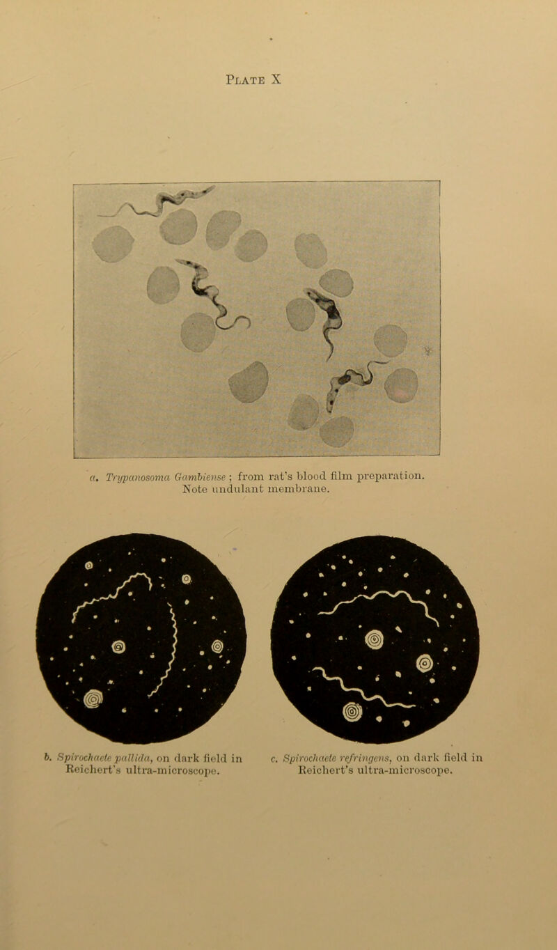a. Trypanosoma Gamhiense ; from rat’s blood film preparation. Note imdulant membrane. b. Spirochacte pallida, on dark field in Reichert’.s ultra-microscope. c. Spirochacte refringens, on dark field in Reichert’s ultra-microscope.